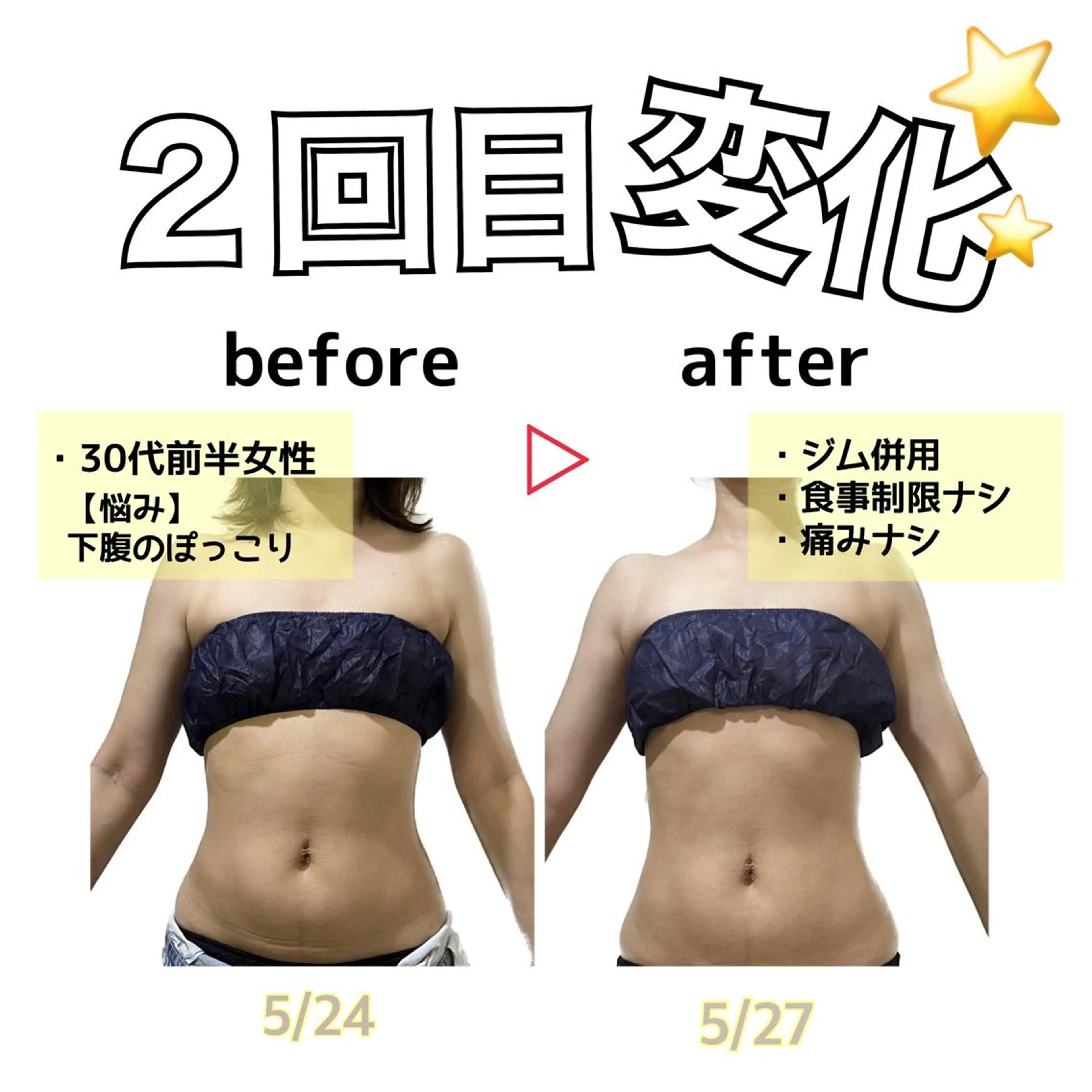 エステ stella所属・stella都度払い 痩身小顔まつげパーマのマツエク・マツパデザイン