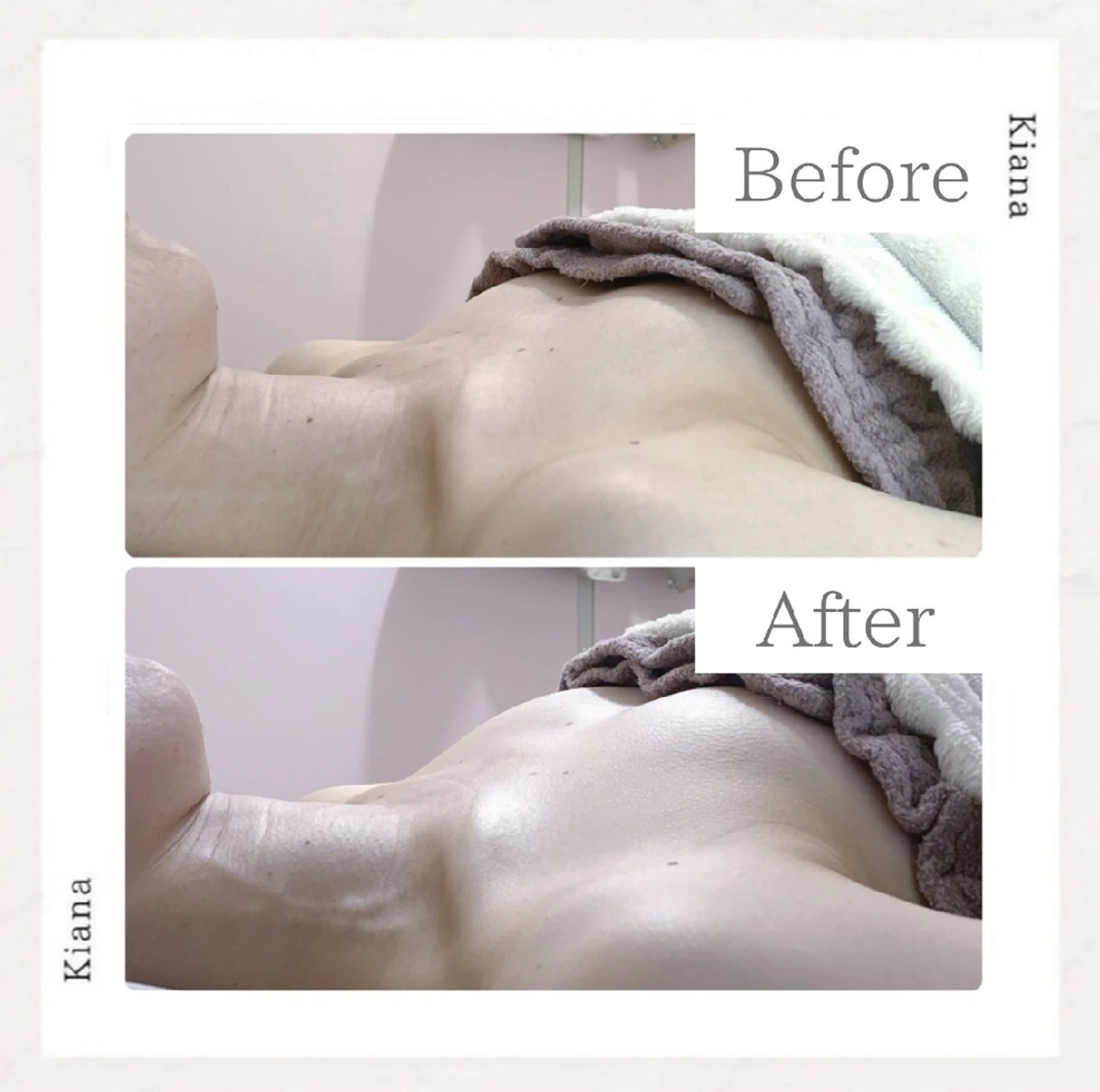 エステ リラク 【バスト専門店 】 Kiana のエステ・リラクイメージ