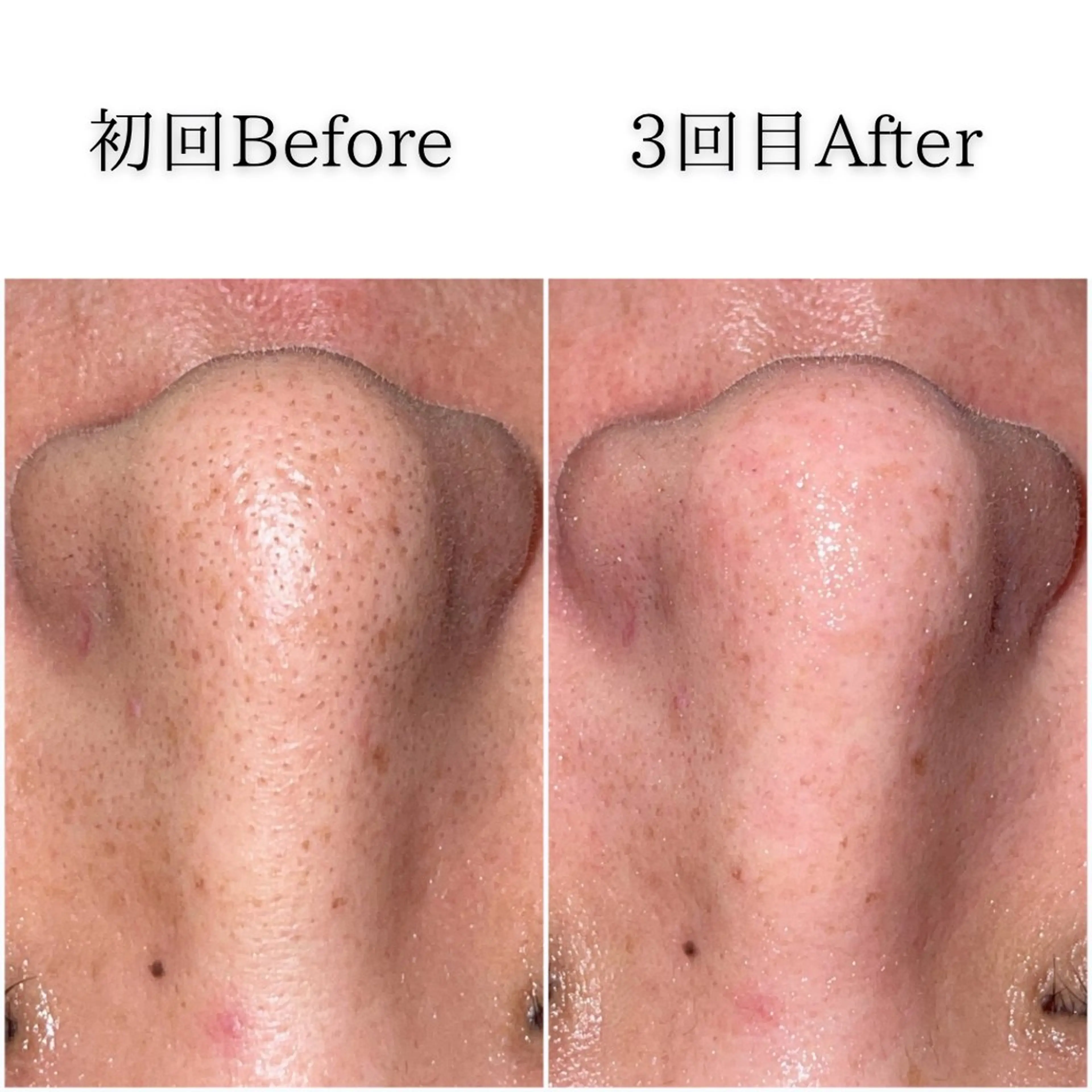 SELF  BEAUTY gracia浦添店所属・gracia 浦添店のその他イメージ