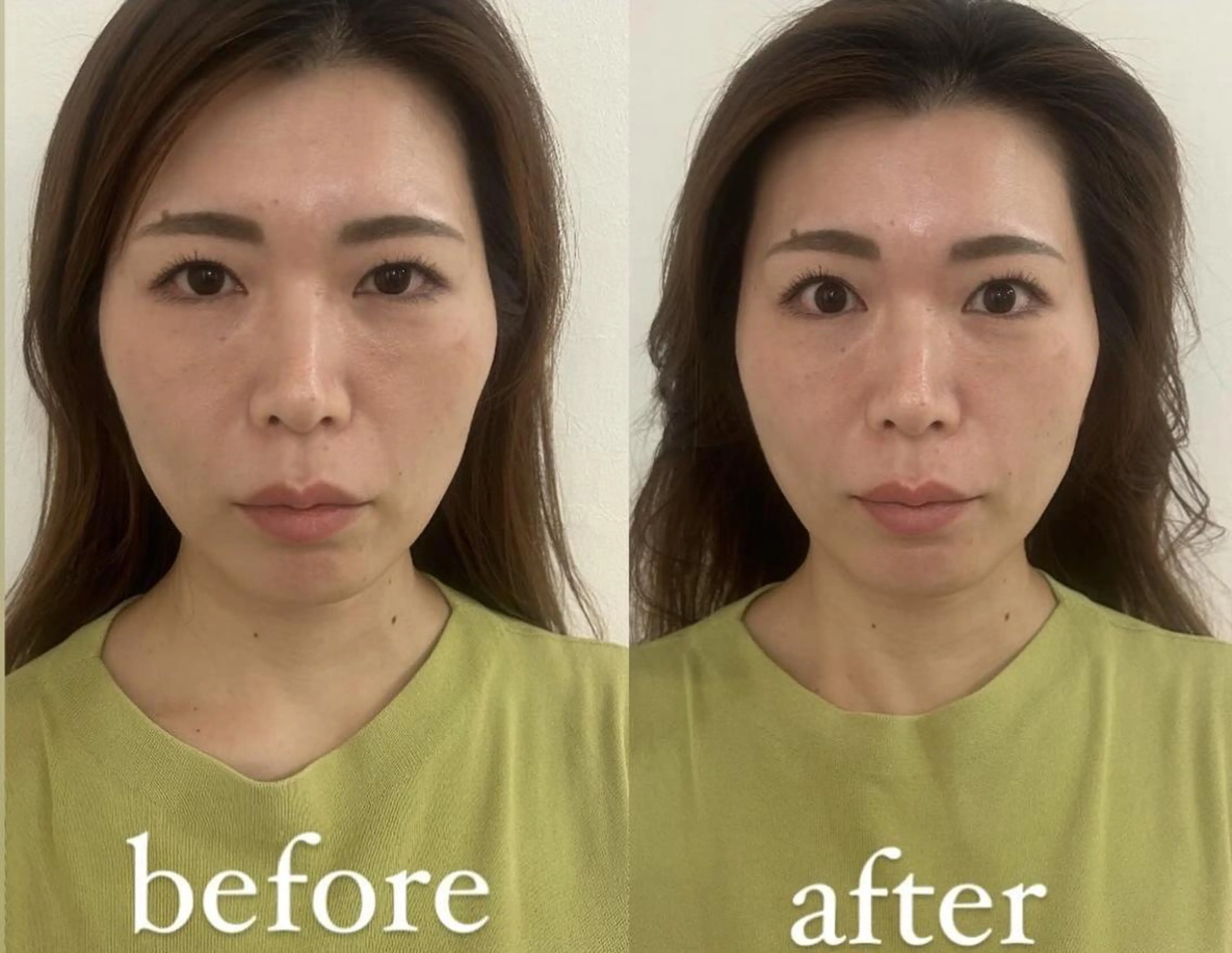 佐藤 咲希のその他イメージ