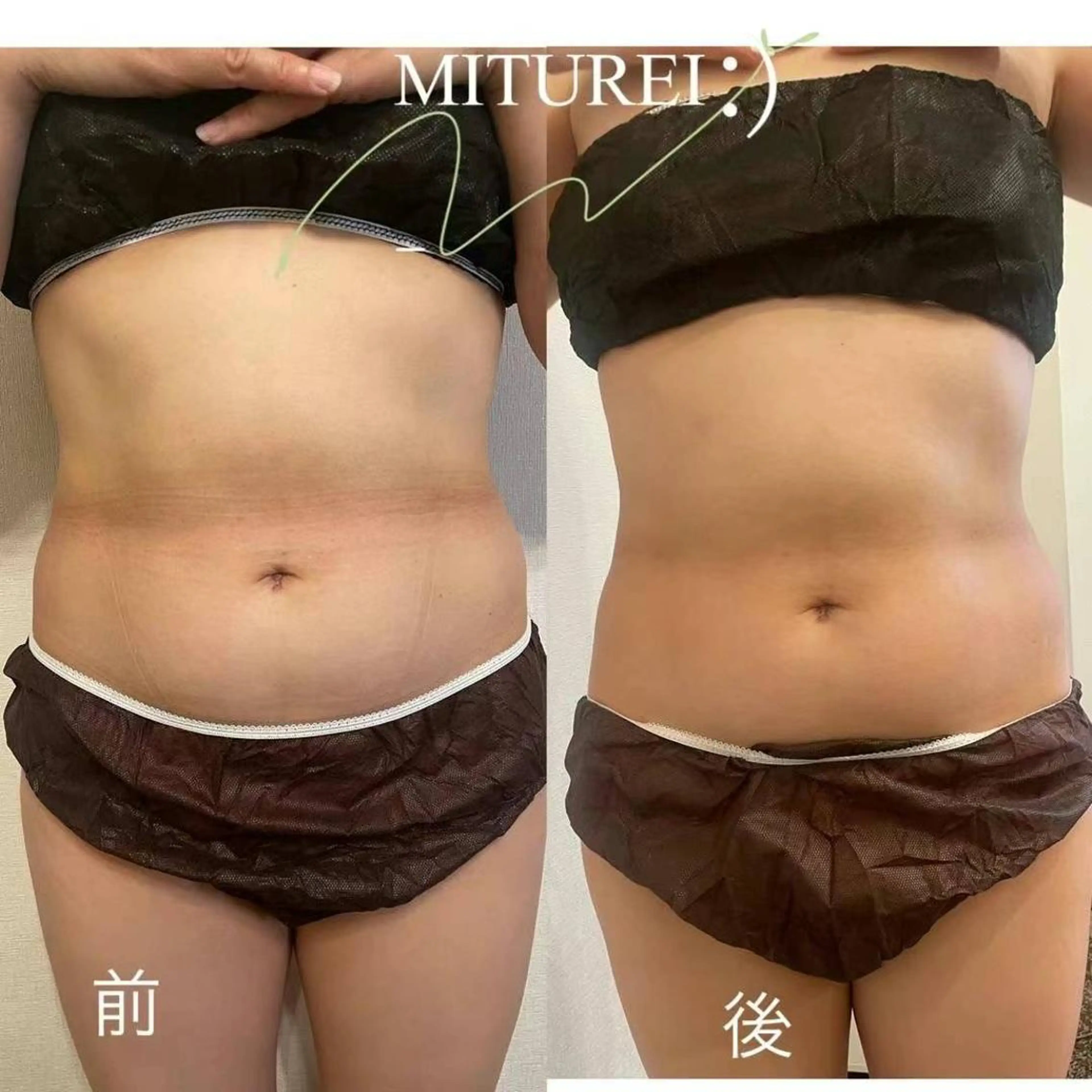 西区九条エステ MITUREIサロンのエステ・リラクイメージ