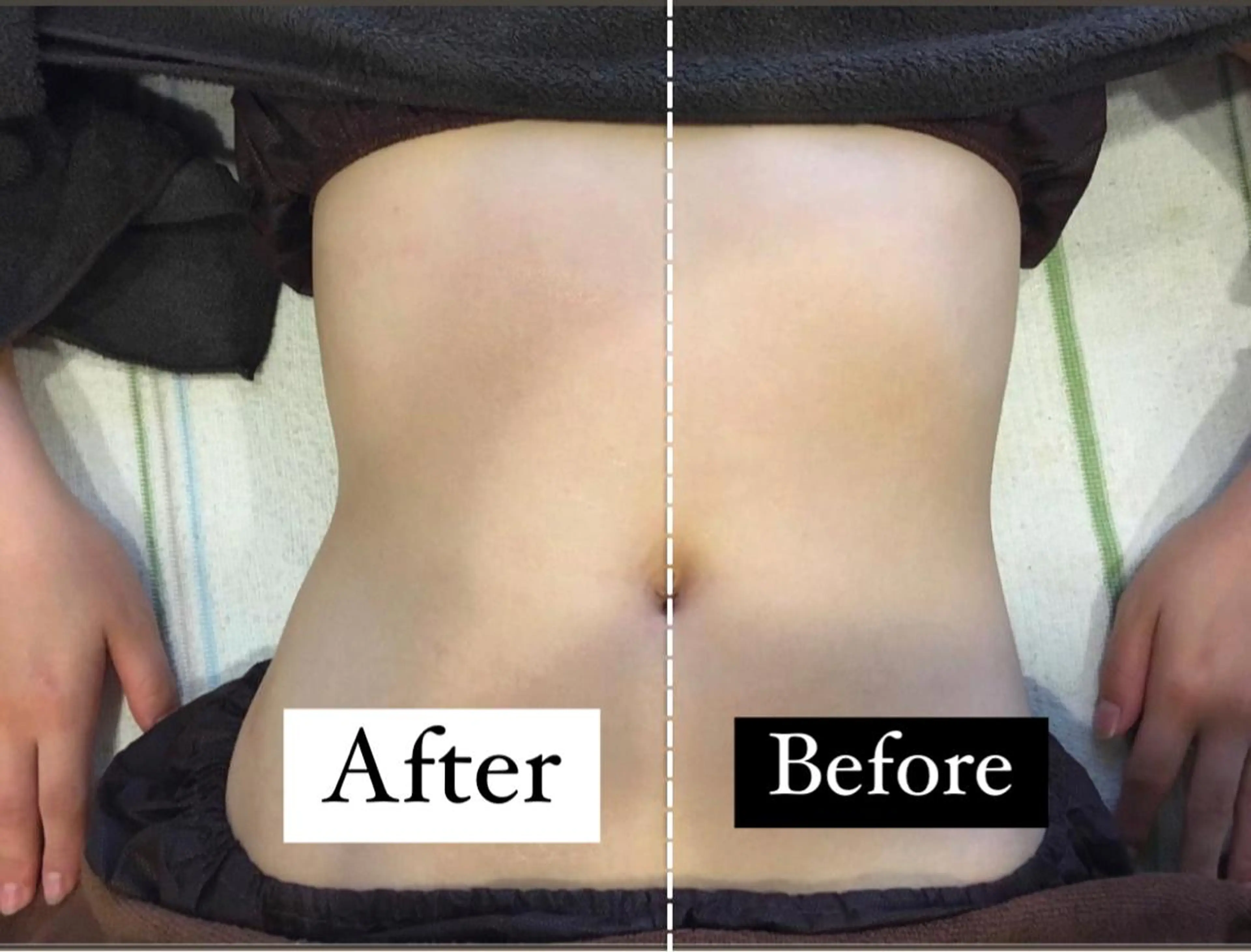 【選べるボディ✨3コース 】二の腕、お腹、腰肉、ヒップ、膝下、膝上（前or裏）からお好きな部位を3コース組み合わせ！の写真