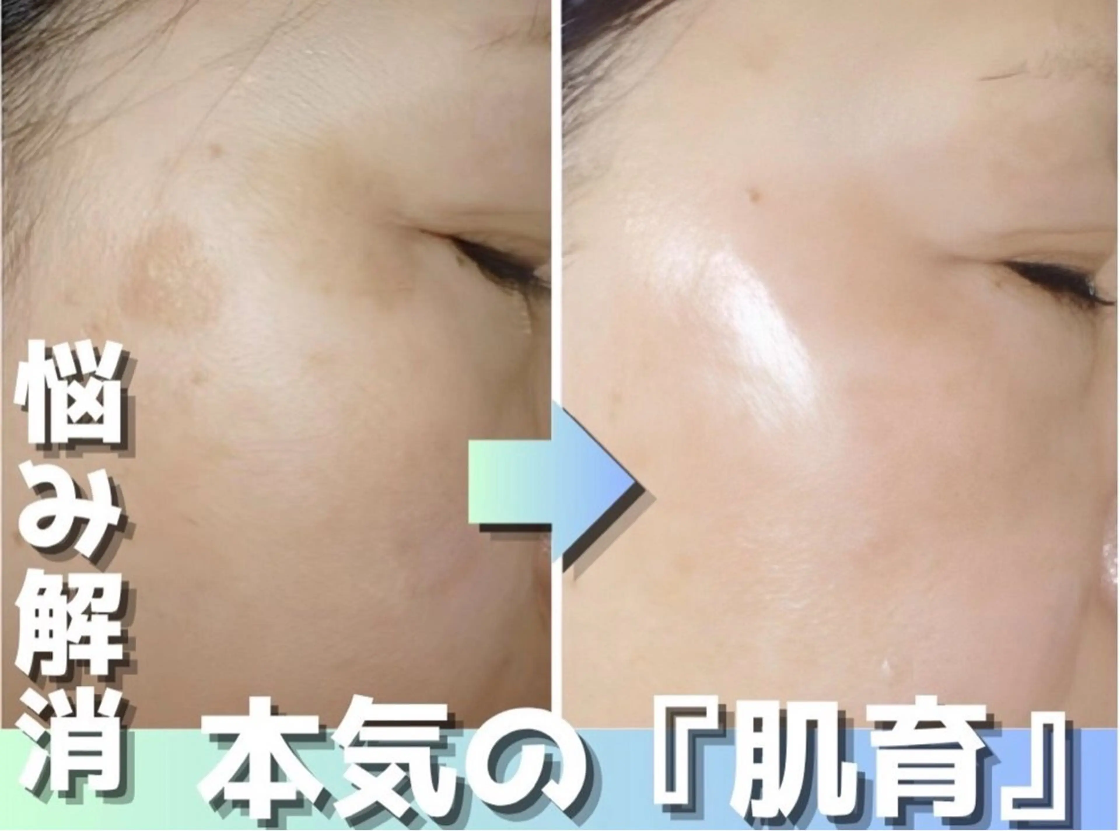 エステ 肌質改善×癒しサロン Bell skinのエステ・リラクイメージ