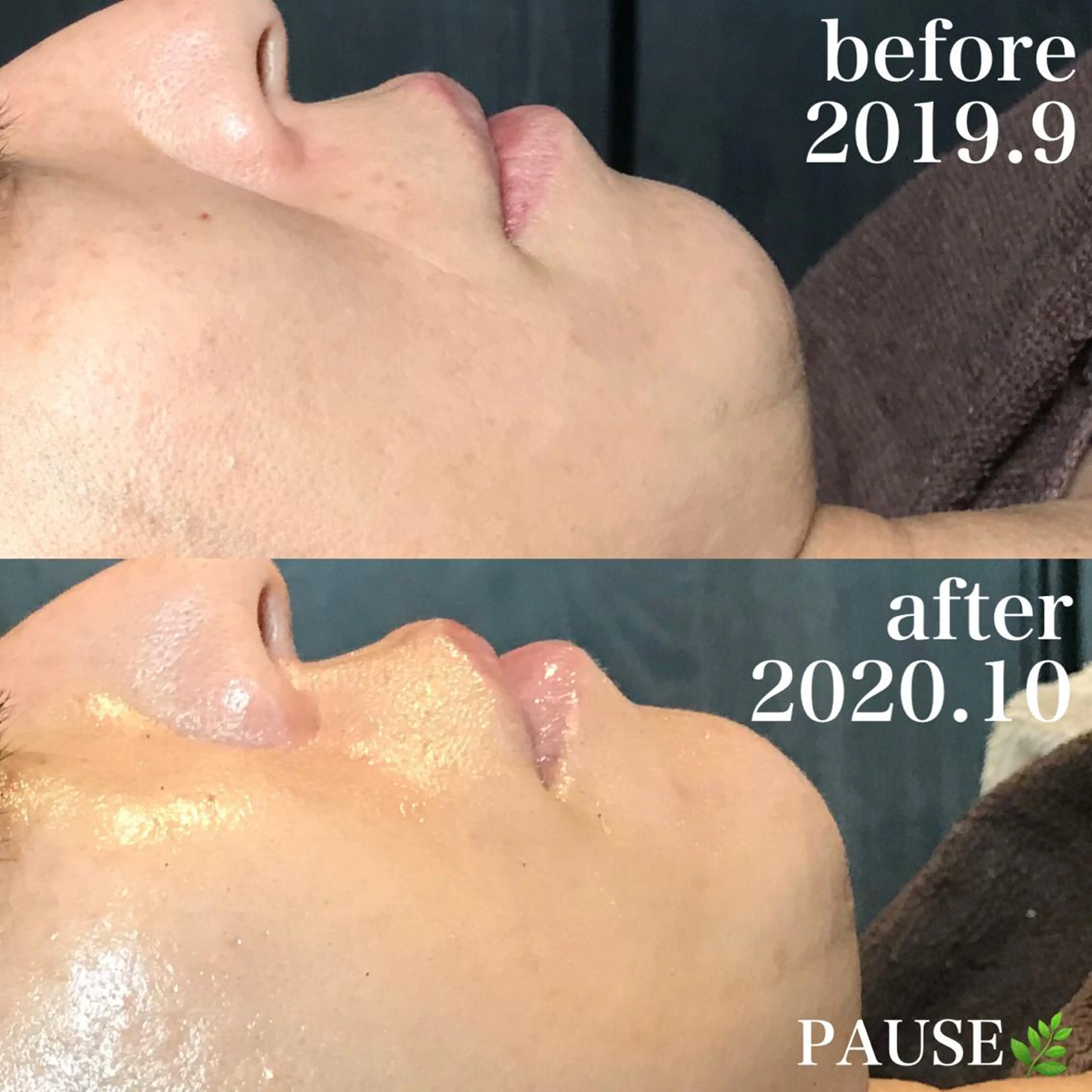 エステ 浜野 恵美のエステ・リラクイメージ