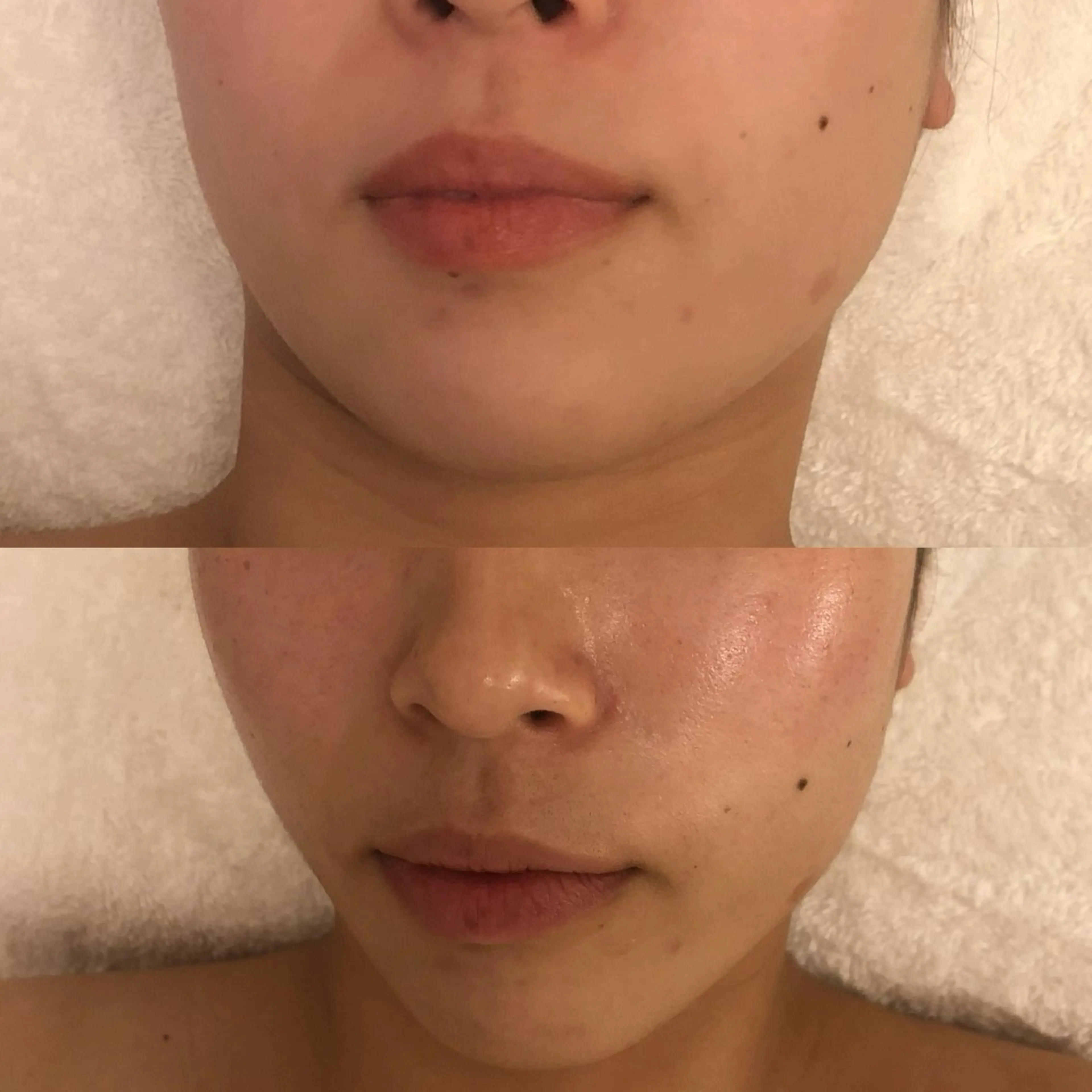 たるみ改善小顔エステ 堀葉月のその他イメージ