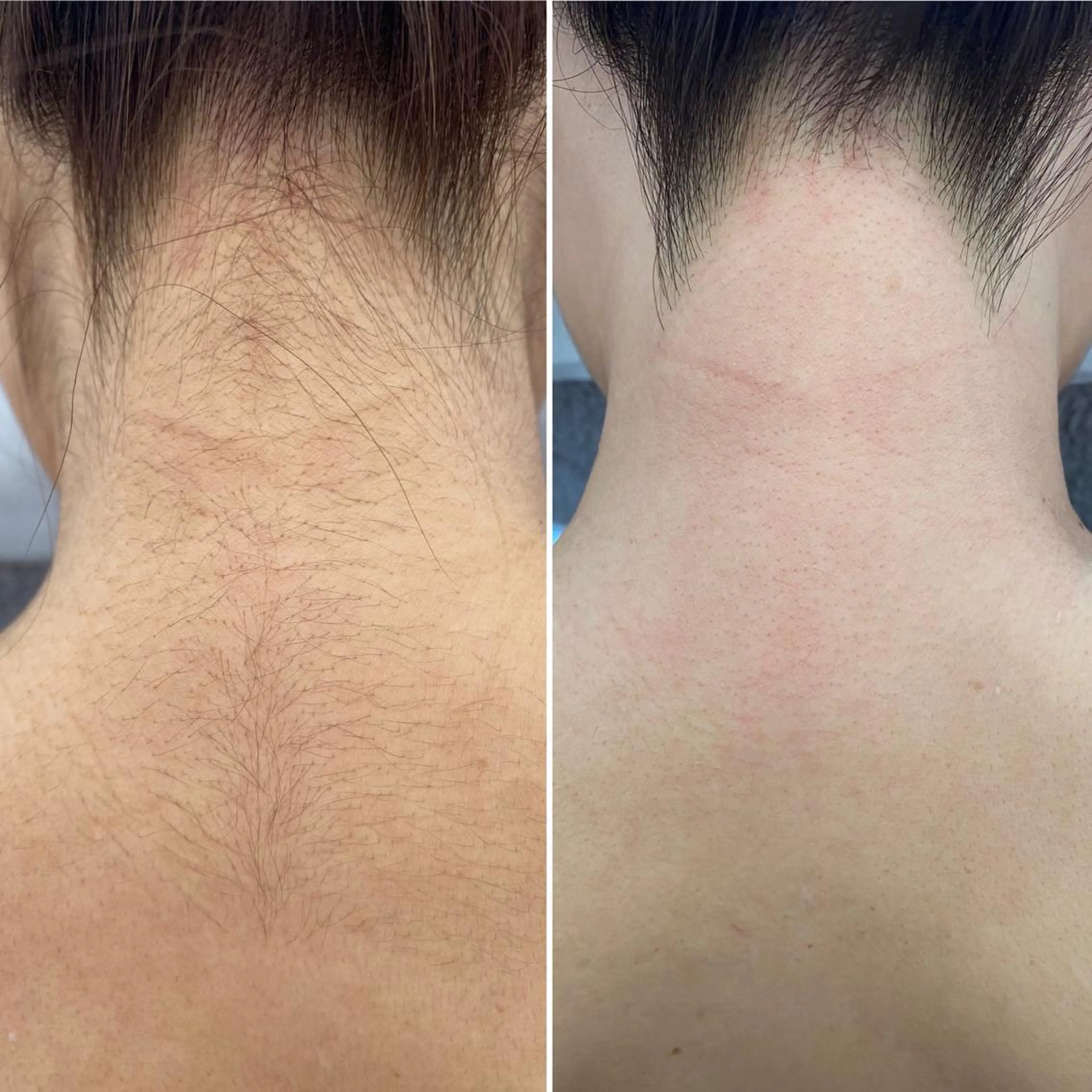 アイブロウ 眉毛ワックス脱毛 ワックス脱毛🌈 ESPOIRnocoのエステ・リラクイメージ