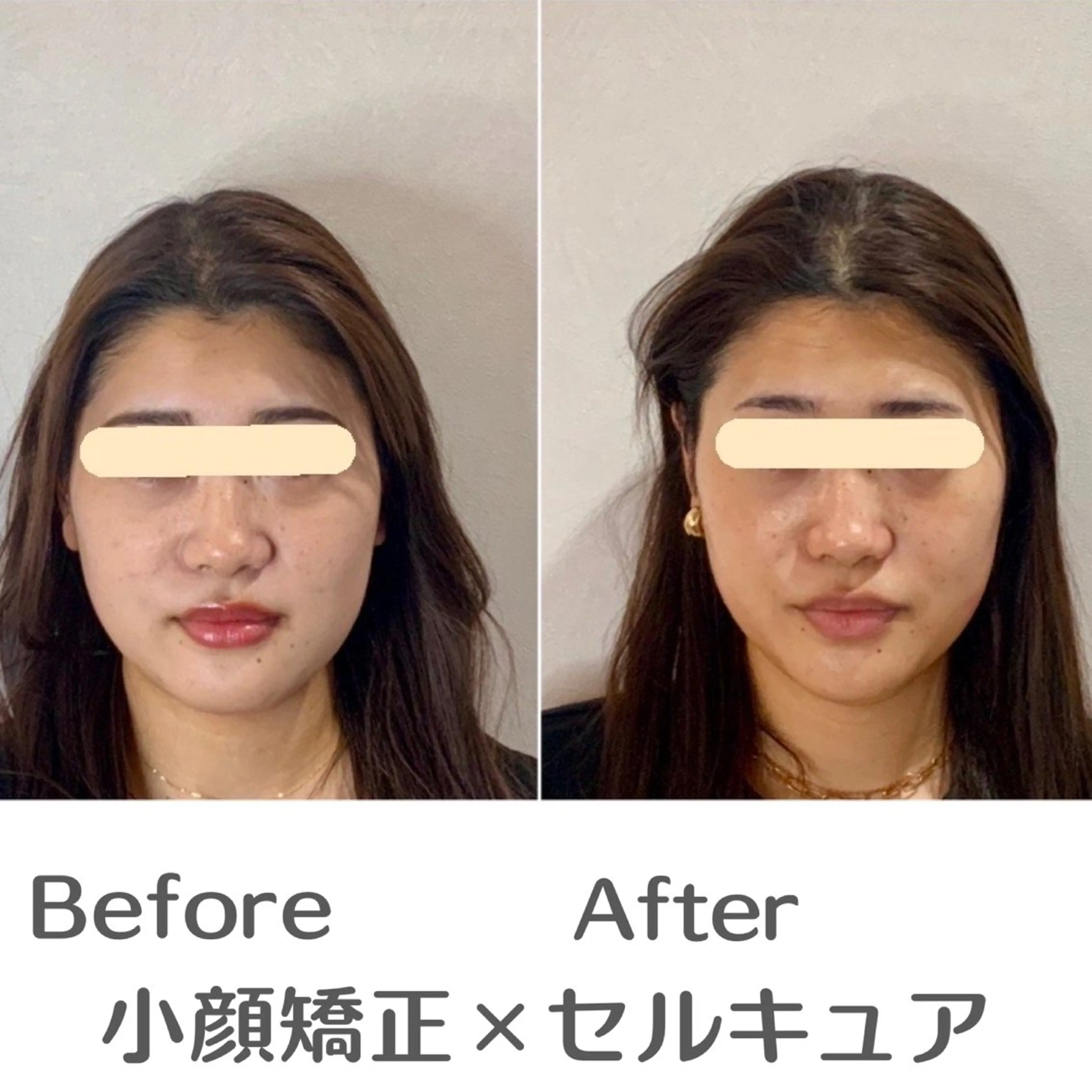 エステ 巻き肩・猫背矯正 小顔　espoirのエステ・リラクイメージ