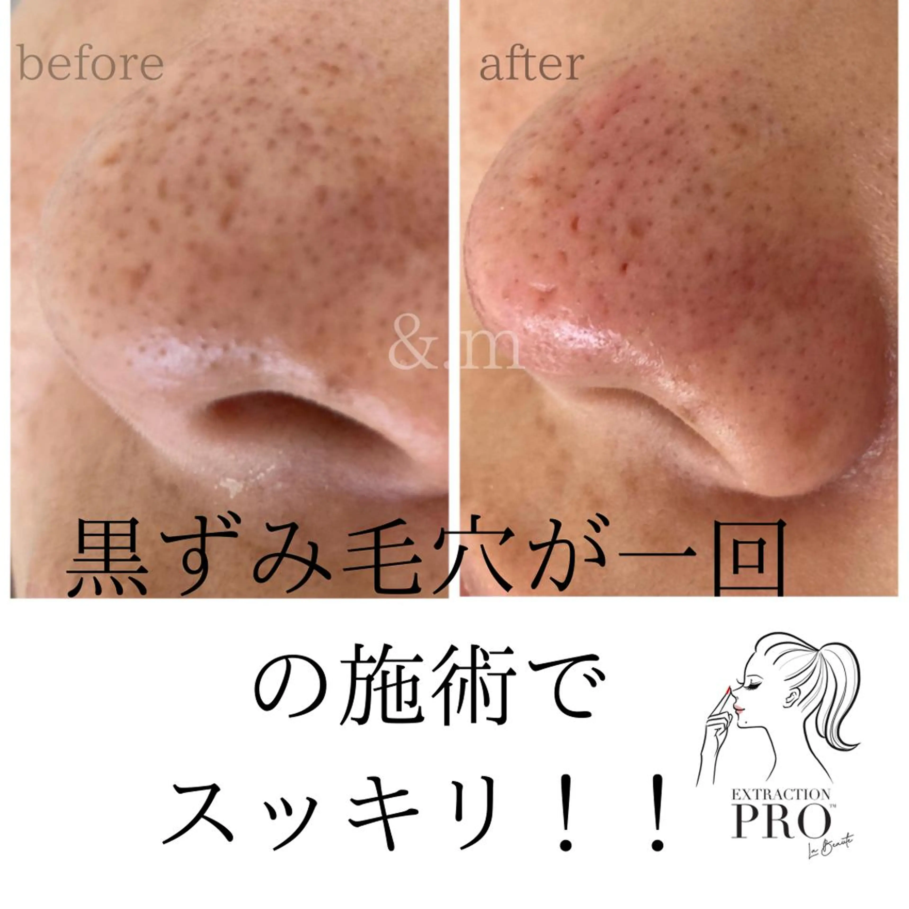 &. mのマツエク・マツパデザイン