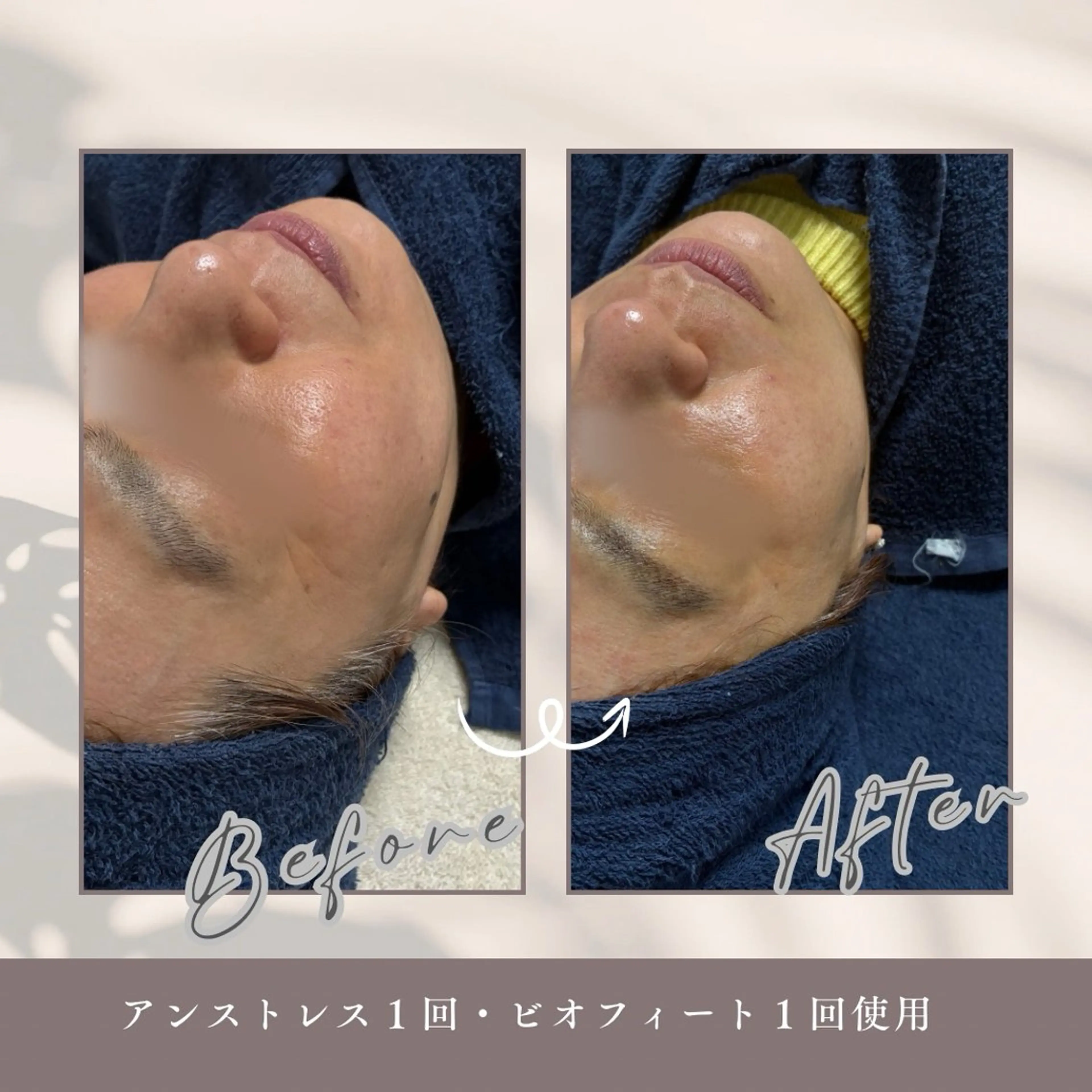 エステ Amor 渡邉のエステ・リラクイメージ