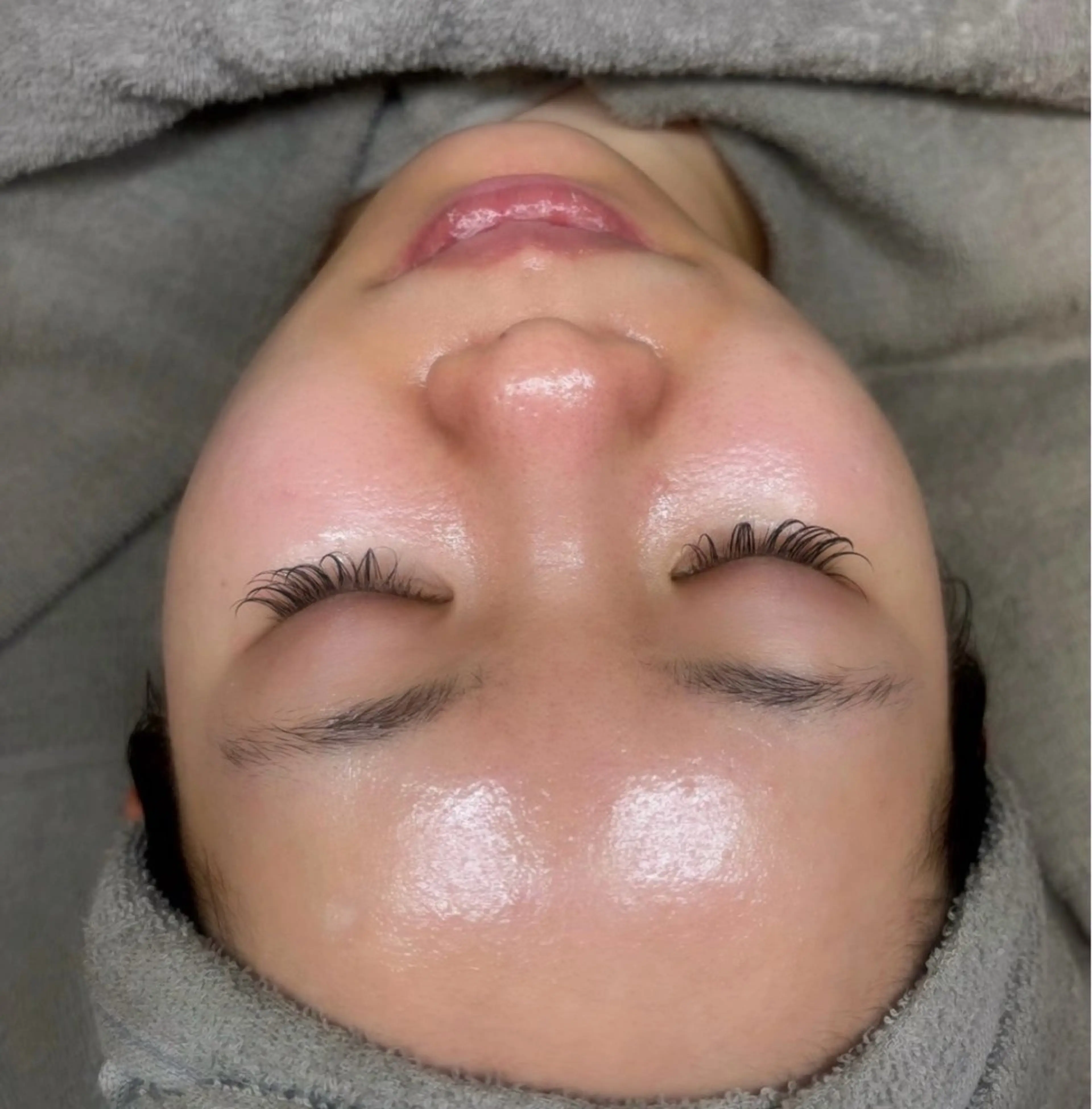 【無針リジュラン】水光肌🇰🇷話題の生サーモン美容液を導入🦋🫧の写真