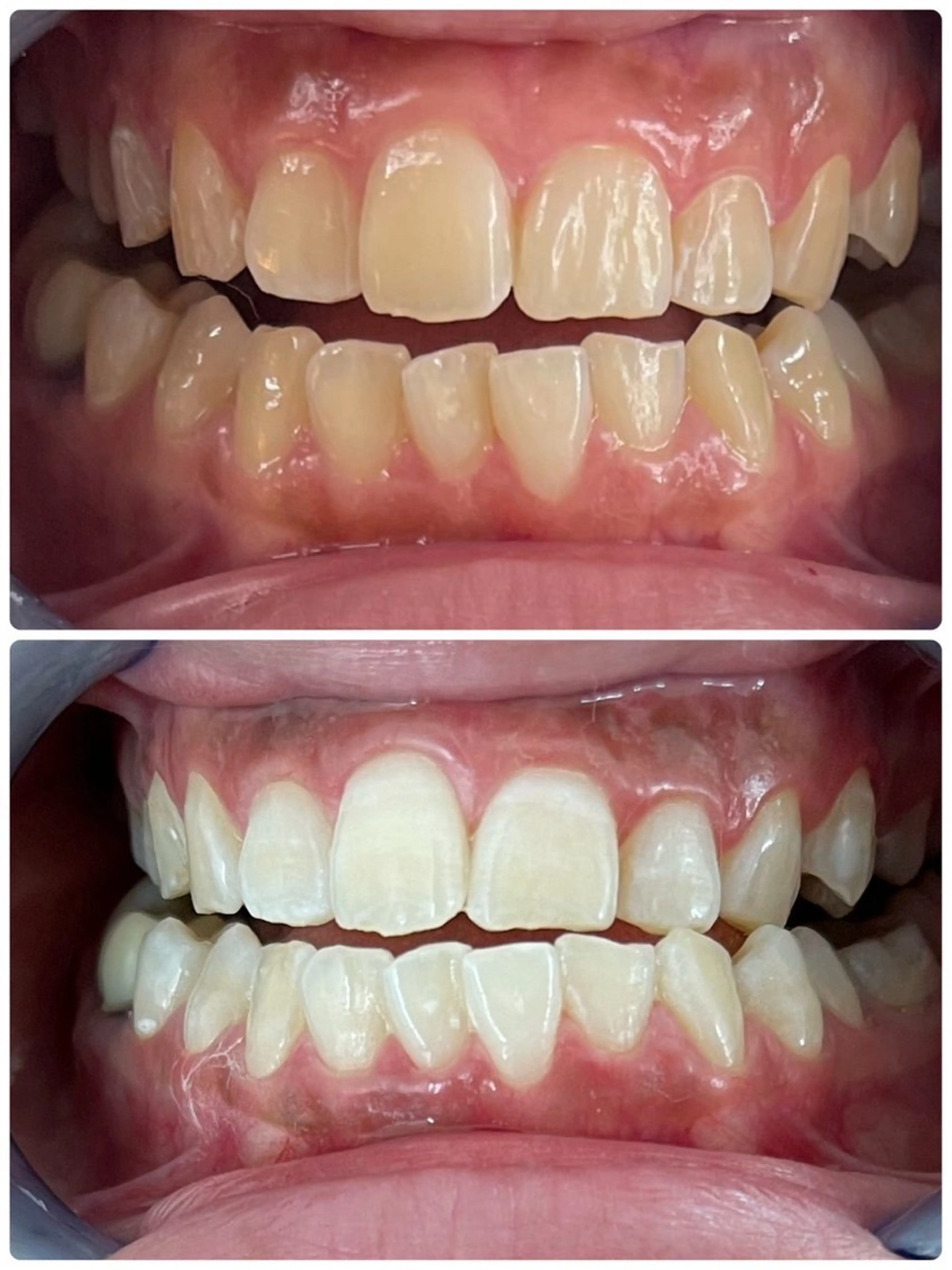 セルフホワイトニング エクシア徳島店マユのその他イメージ