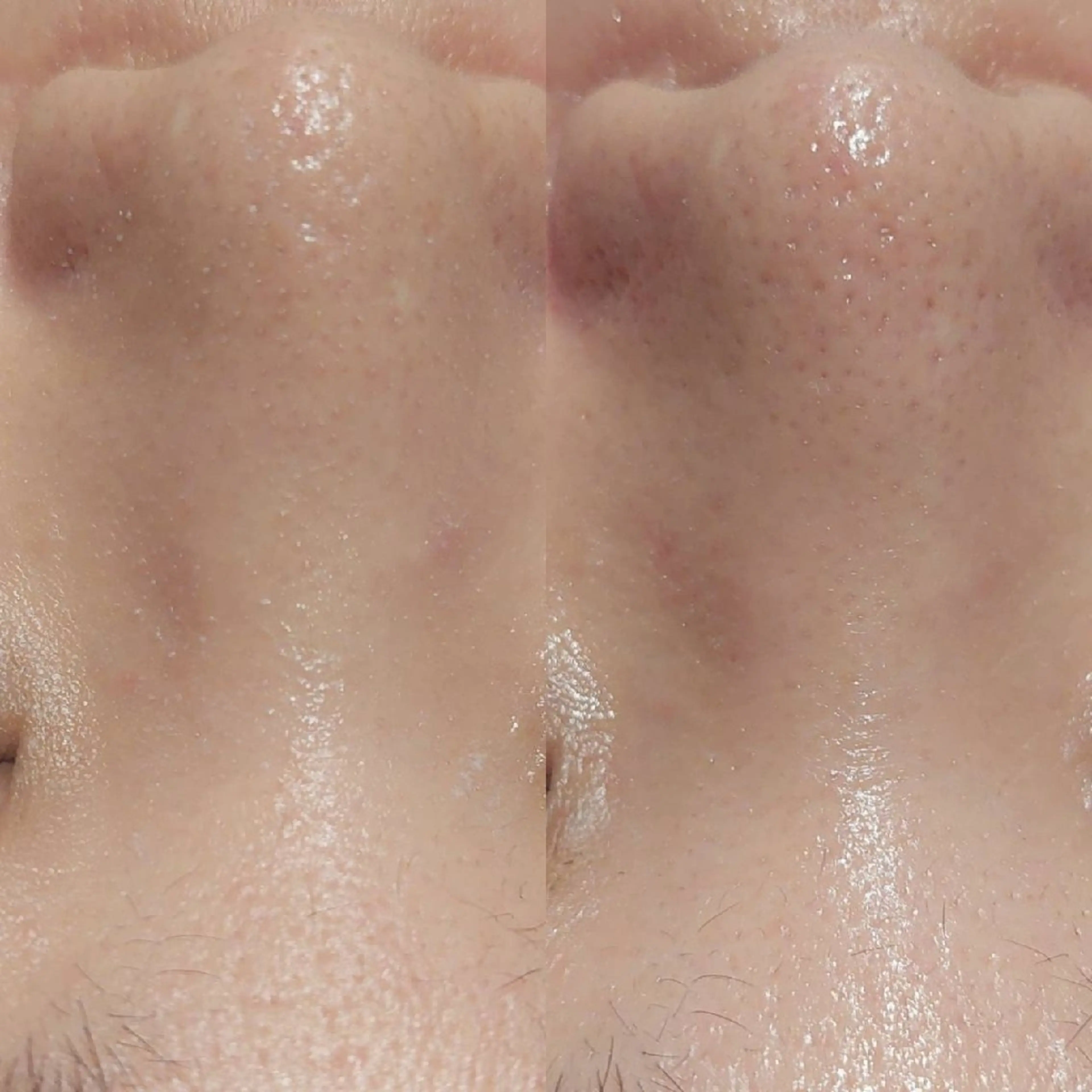 エステ MyFairLady miuのエステ・リラクイメージ