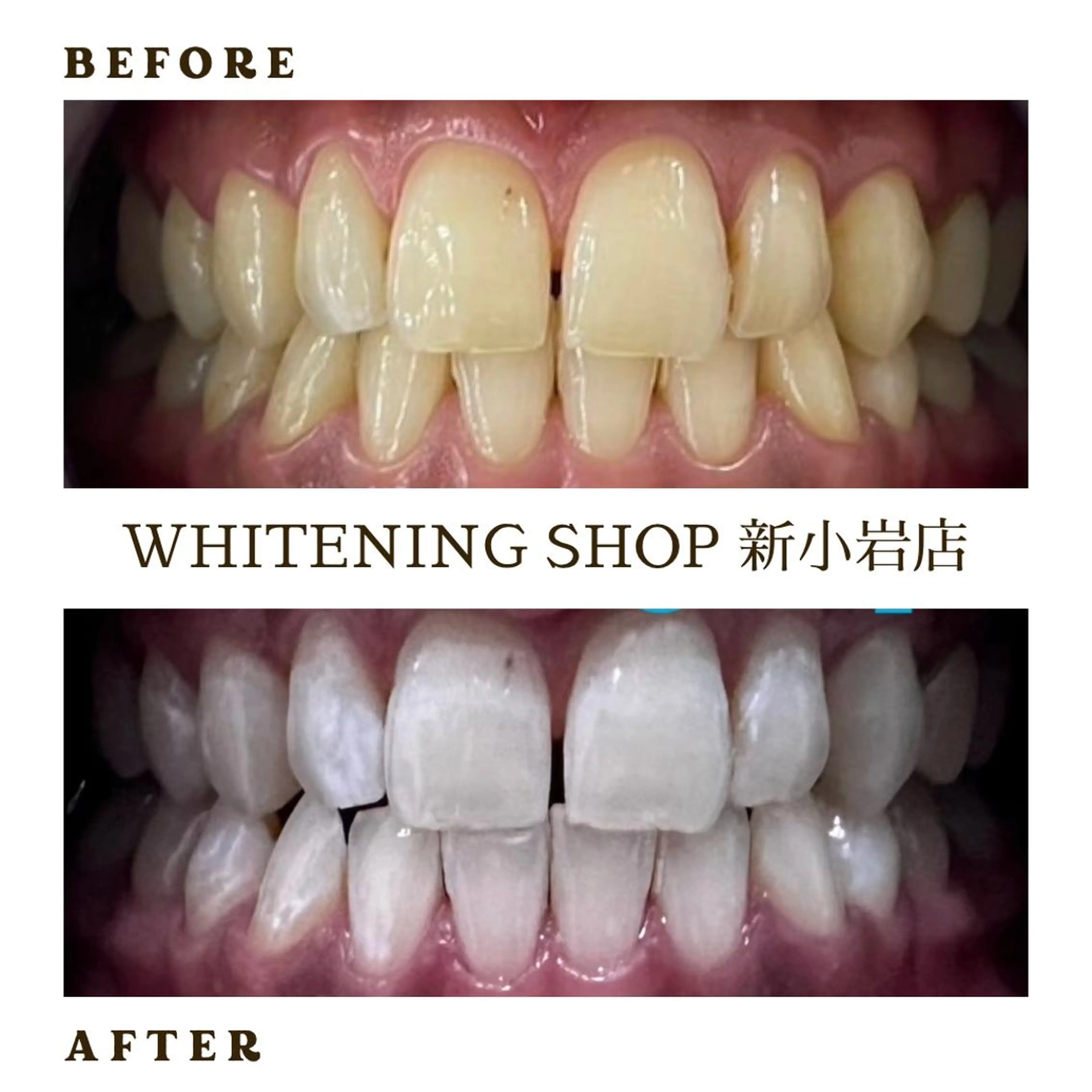 キッズ メンズ その他 ホワイトニング ショップ新小岩店のその他イメージ