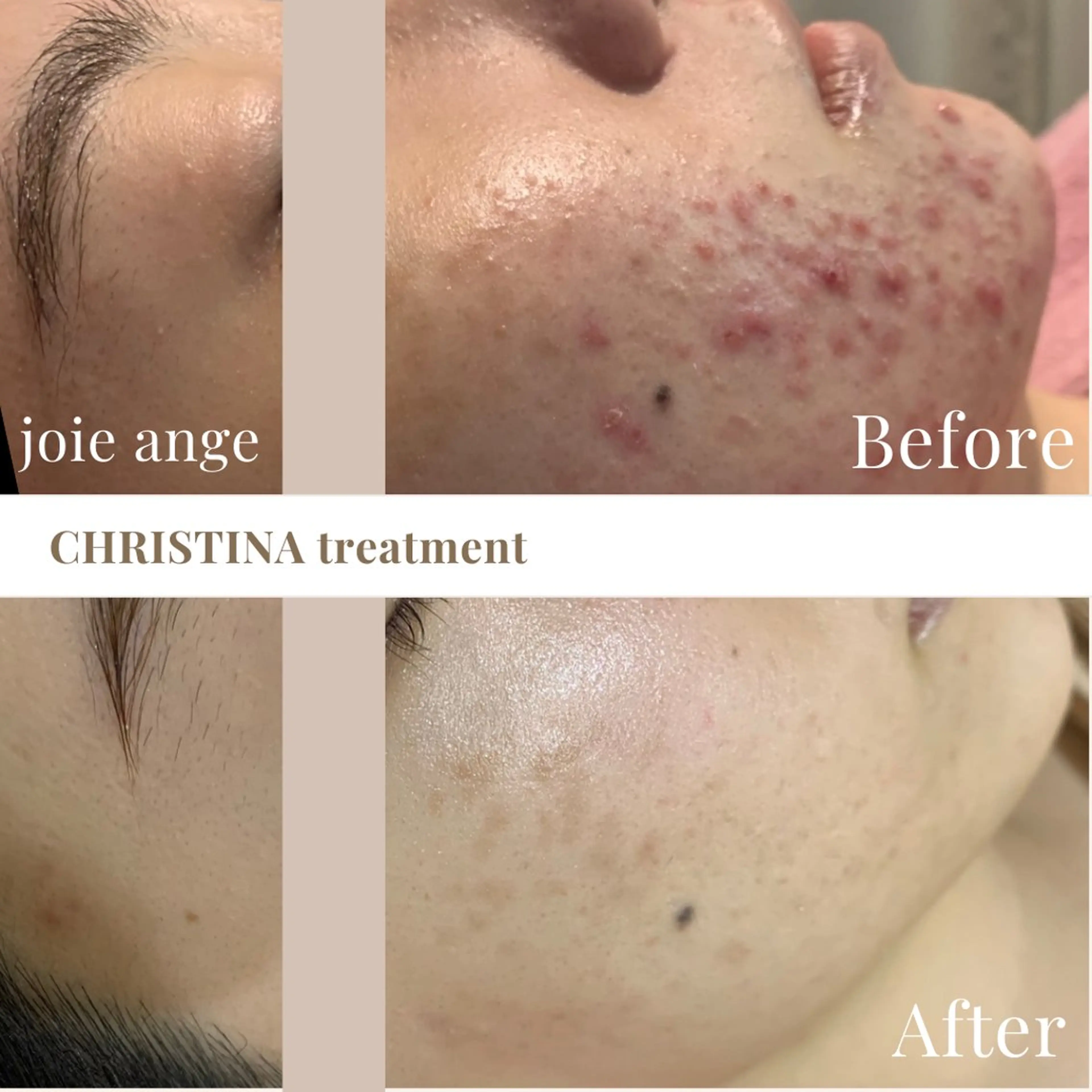 フェイシャル/脱毛 ジョアアンジェ さきのエステ・リラクイメージ