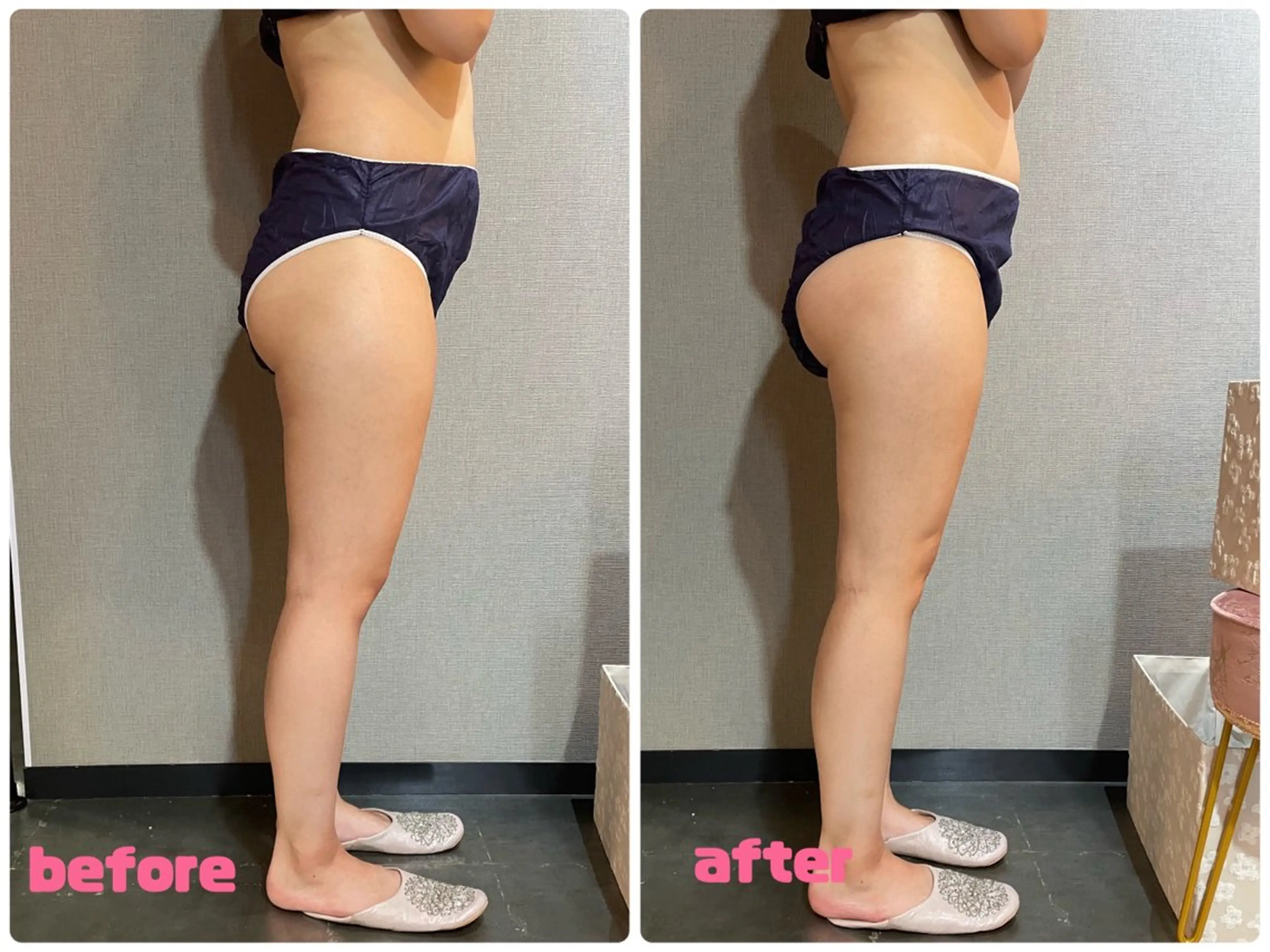 完全個室サロン Anjirのエステ・リラクイメージ