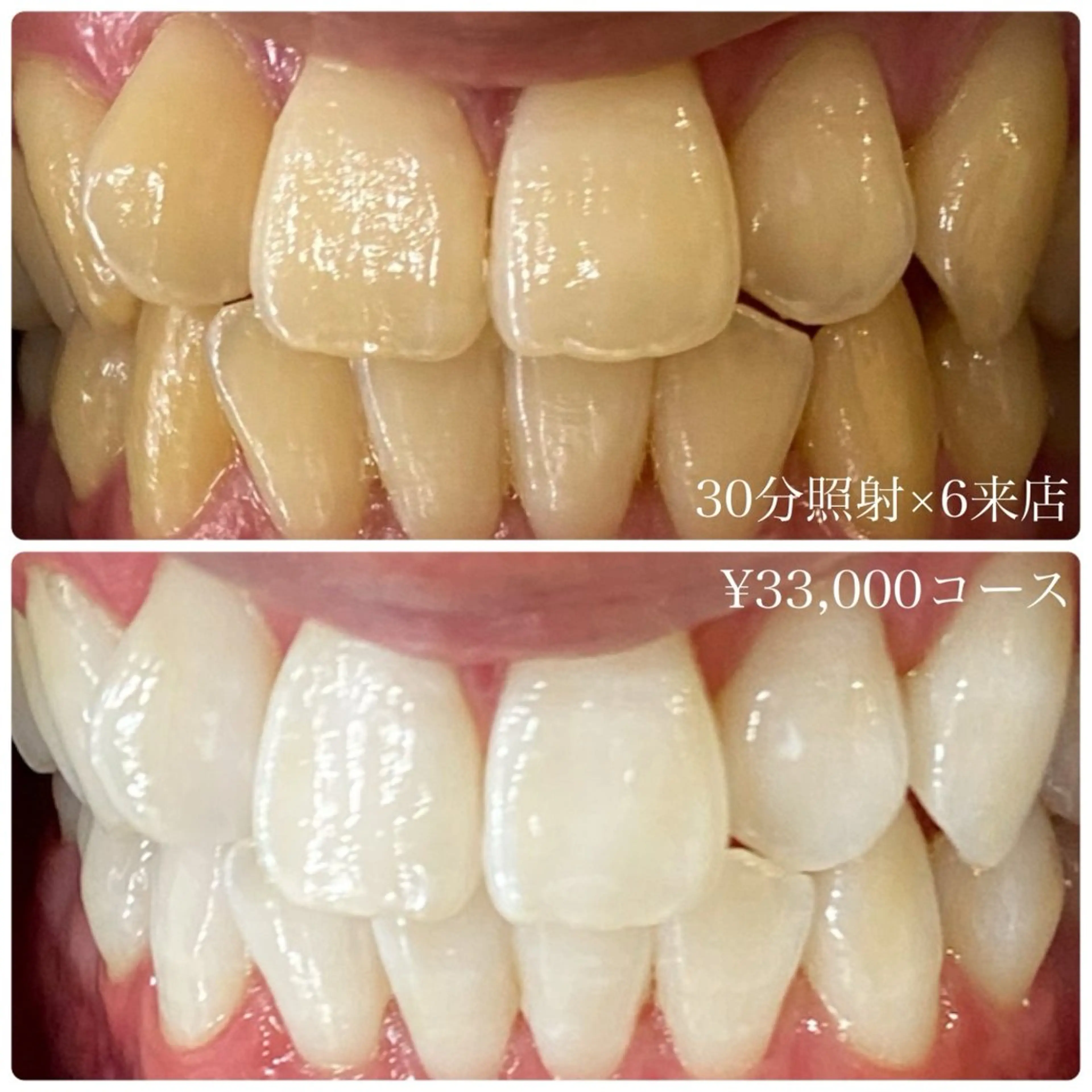 その他 PLATINUM Beauty 横浜店所属・ホワイトニングルーム 横浜店のその他イメージ