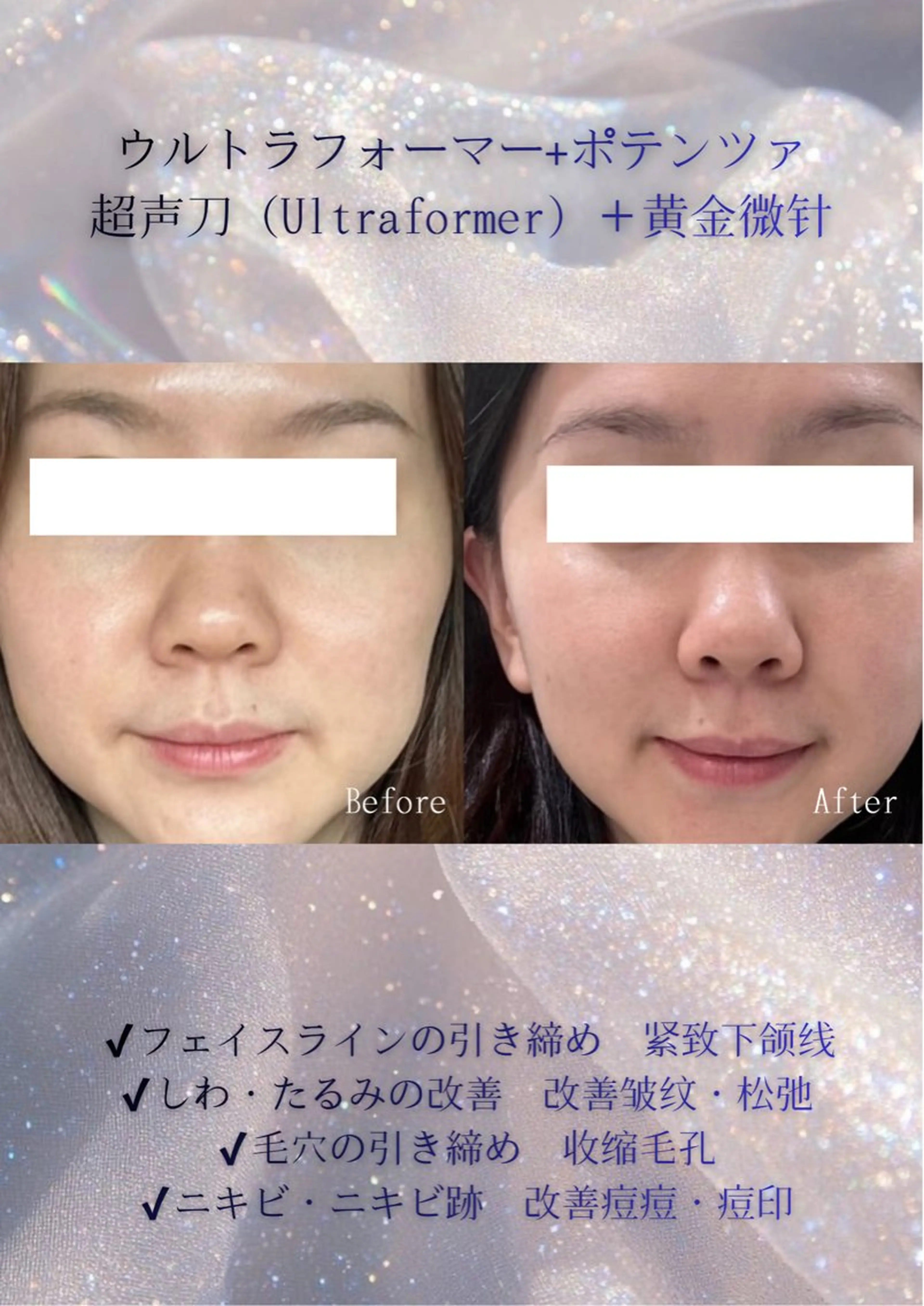 マツエク・マツパ エステ 愛維美水光美肌専門店 メンズレディースokのエステ・リラクイメージ