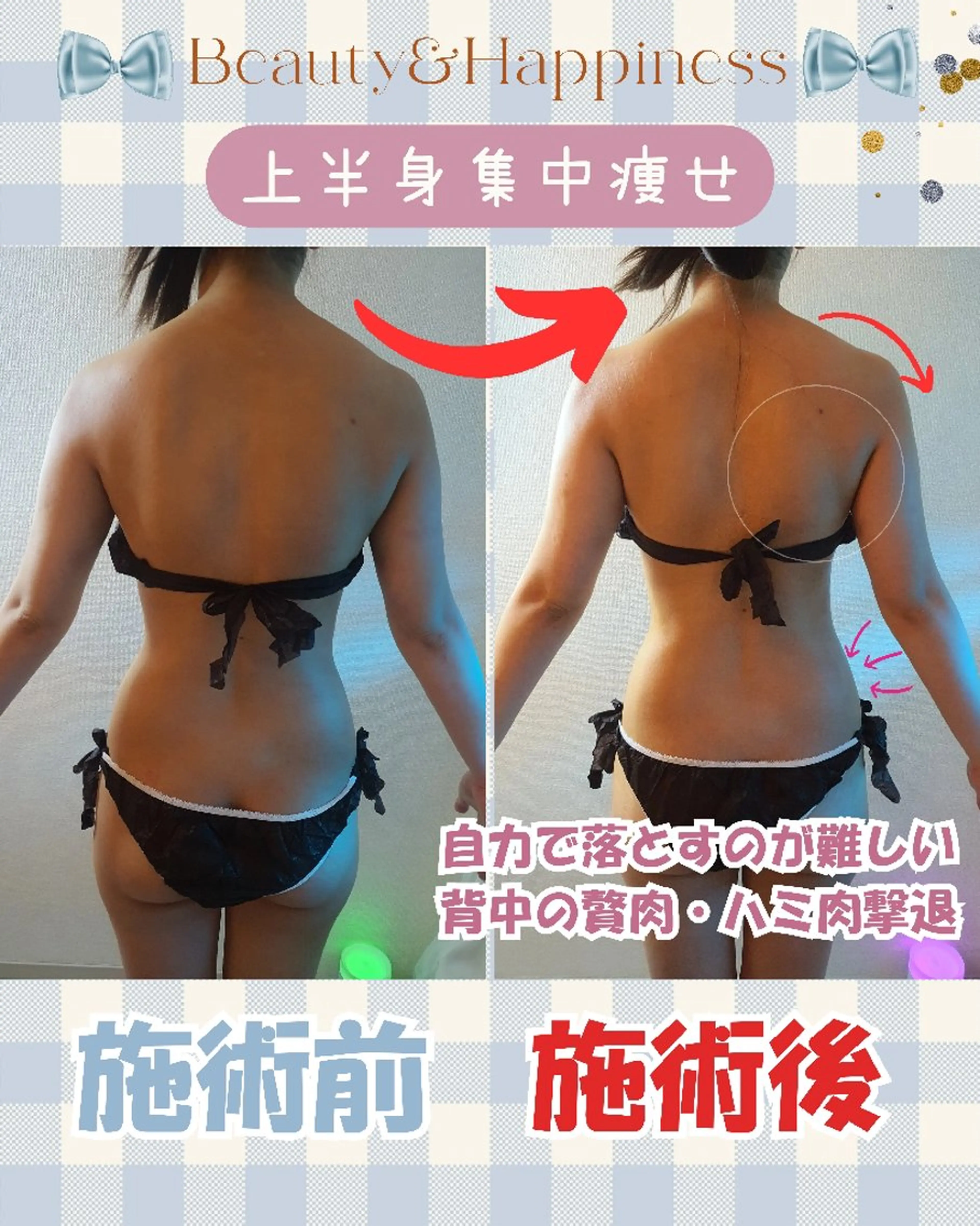 痩身ハーブピーリング 筋膜リリース☆B&Hのエステ・リラクイメージ