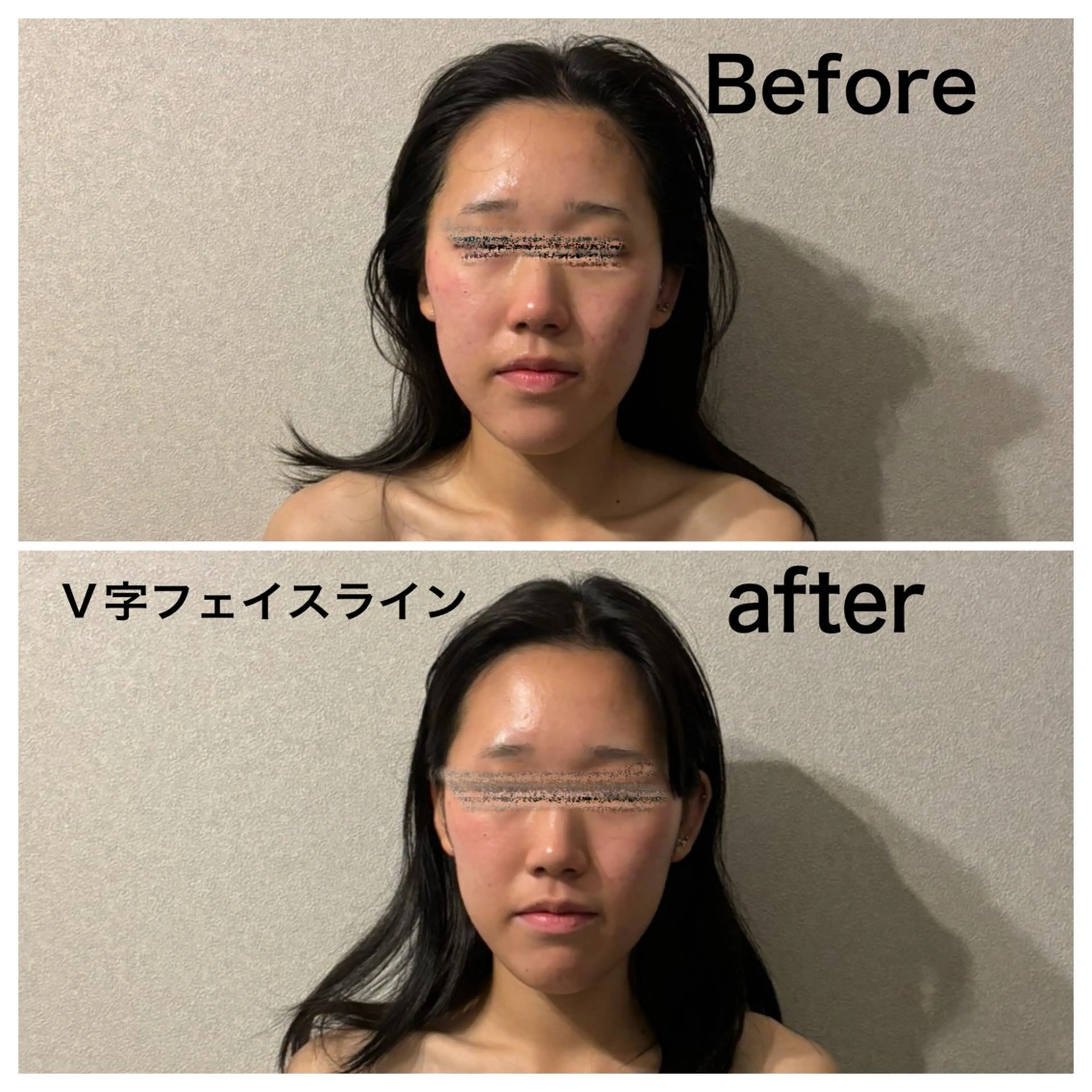 圧倒的たるみ改善 美容鍼エステのエステ・リラクイメージ