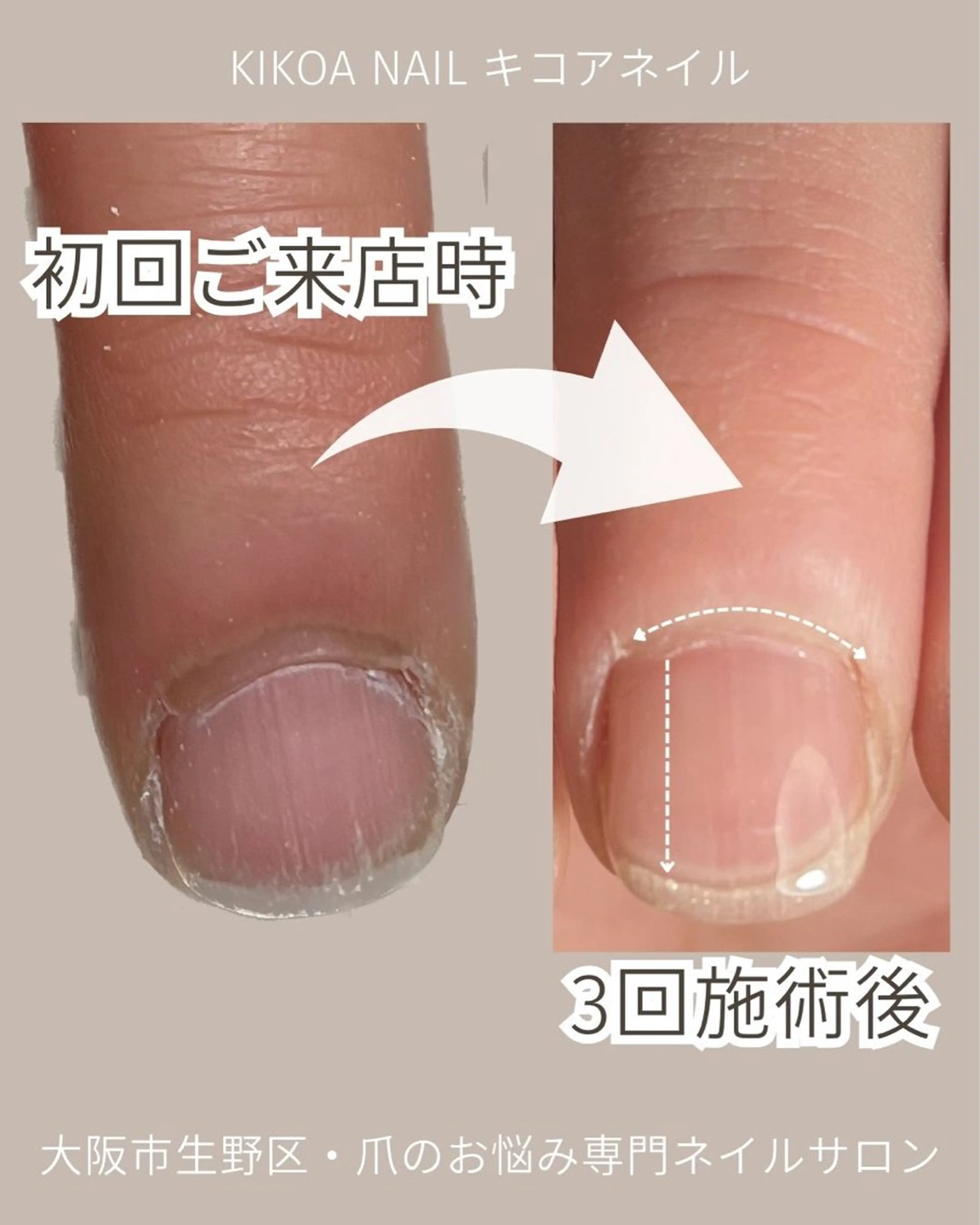 ネイル KIKOA NAIL キコアネイルのネイルデザイン