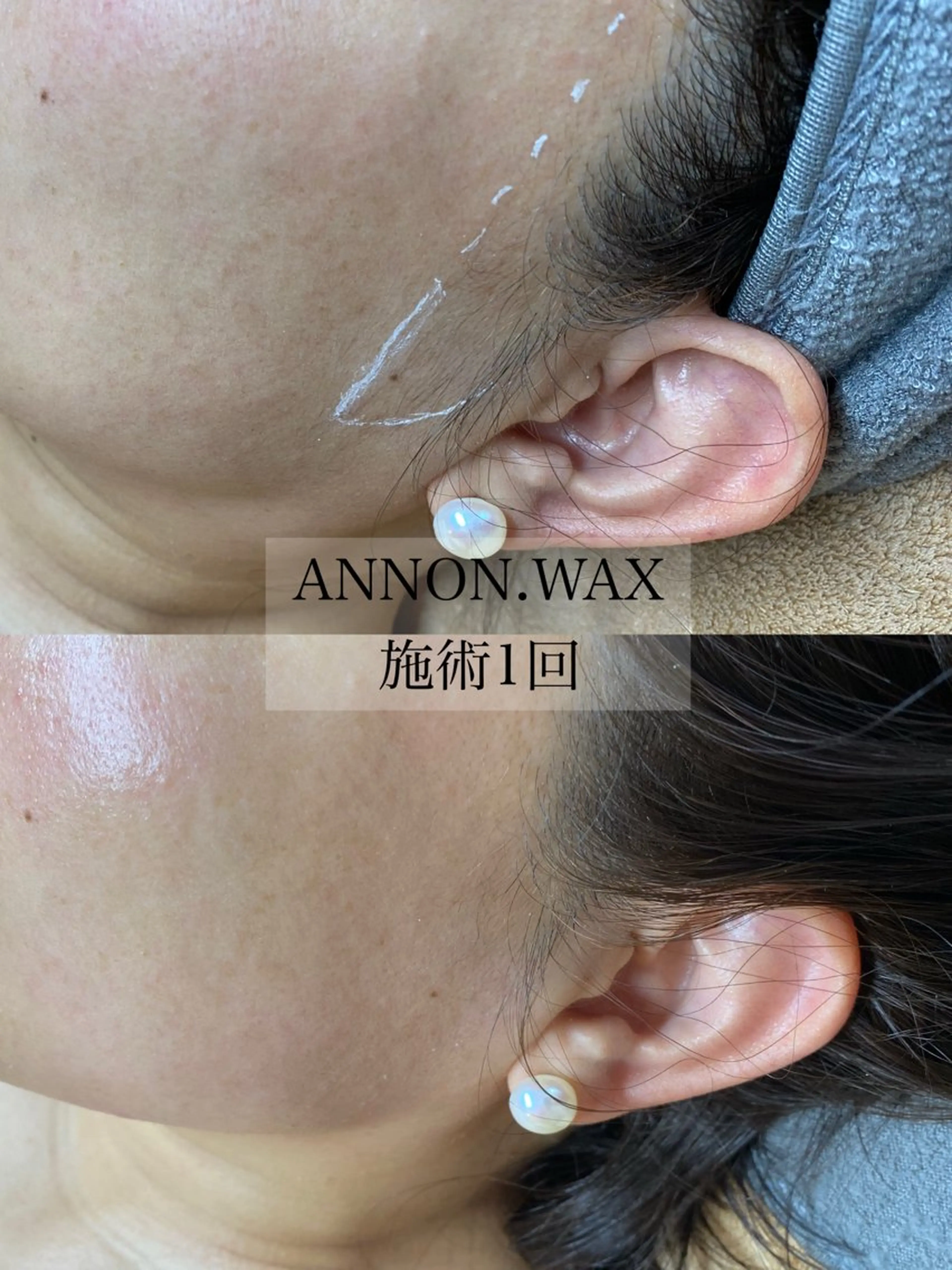 エステ 肌質改善ワックス専門 yukiのエステ・リラクイメージ