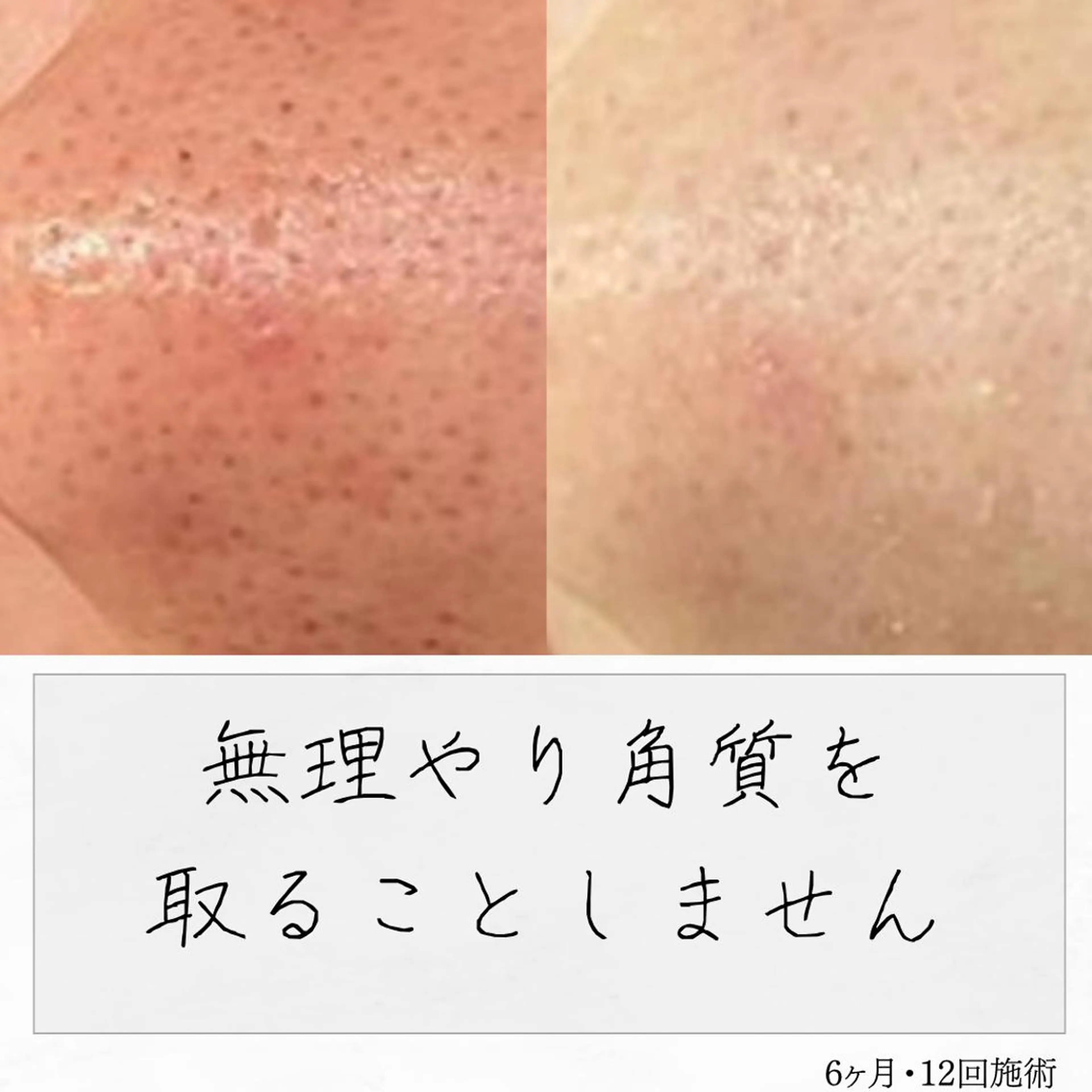 ニキビ経験者が施術 する専門サロン🌻のエステ・リラクイメージ