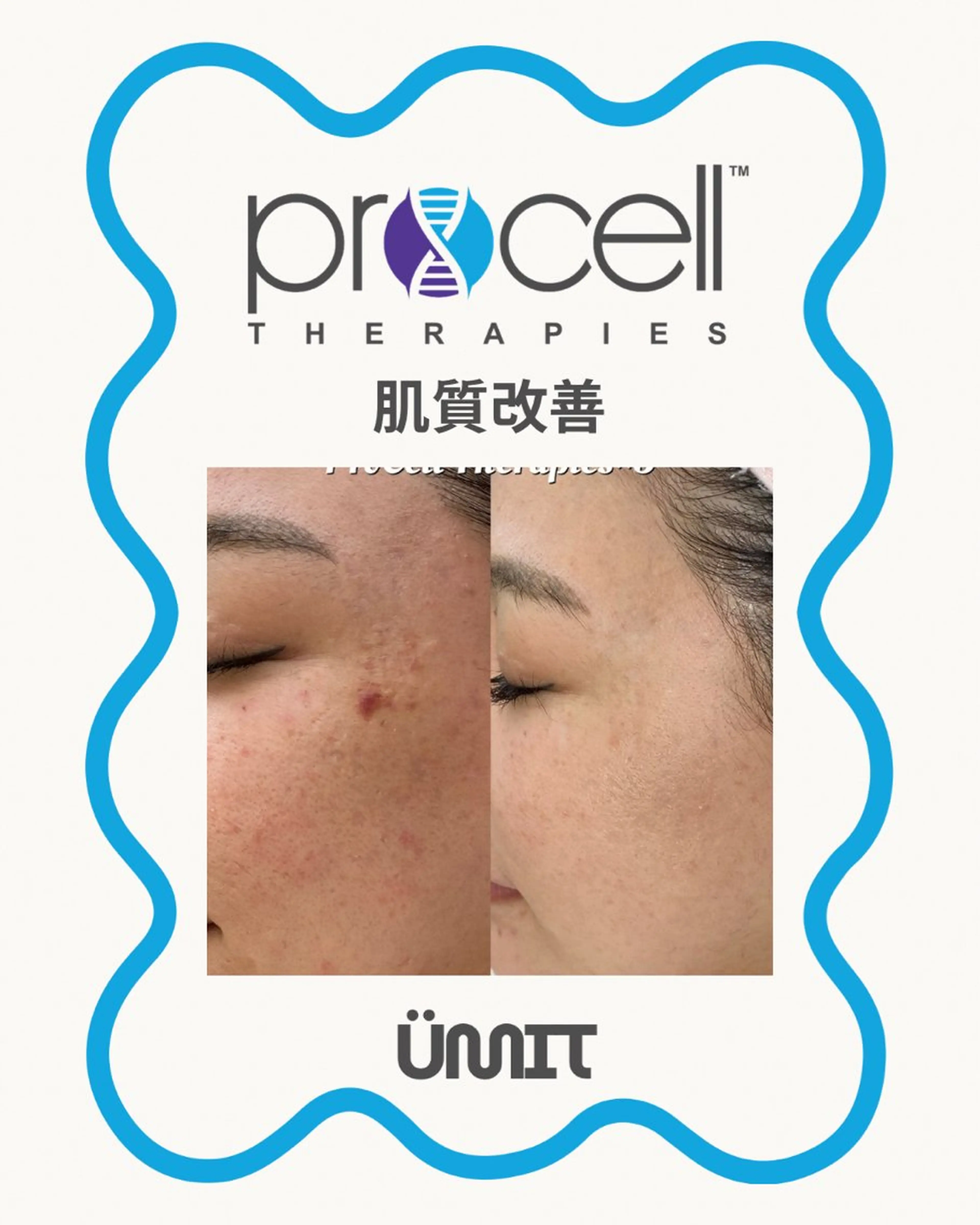 エステ Ümit（ユミト） プロセルセラピーズのネイルデザイン