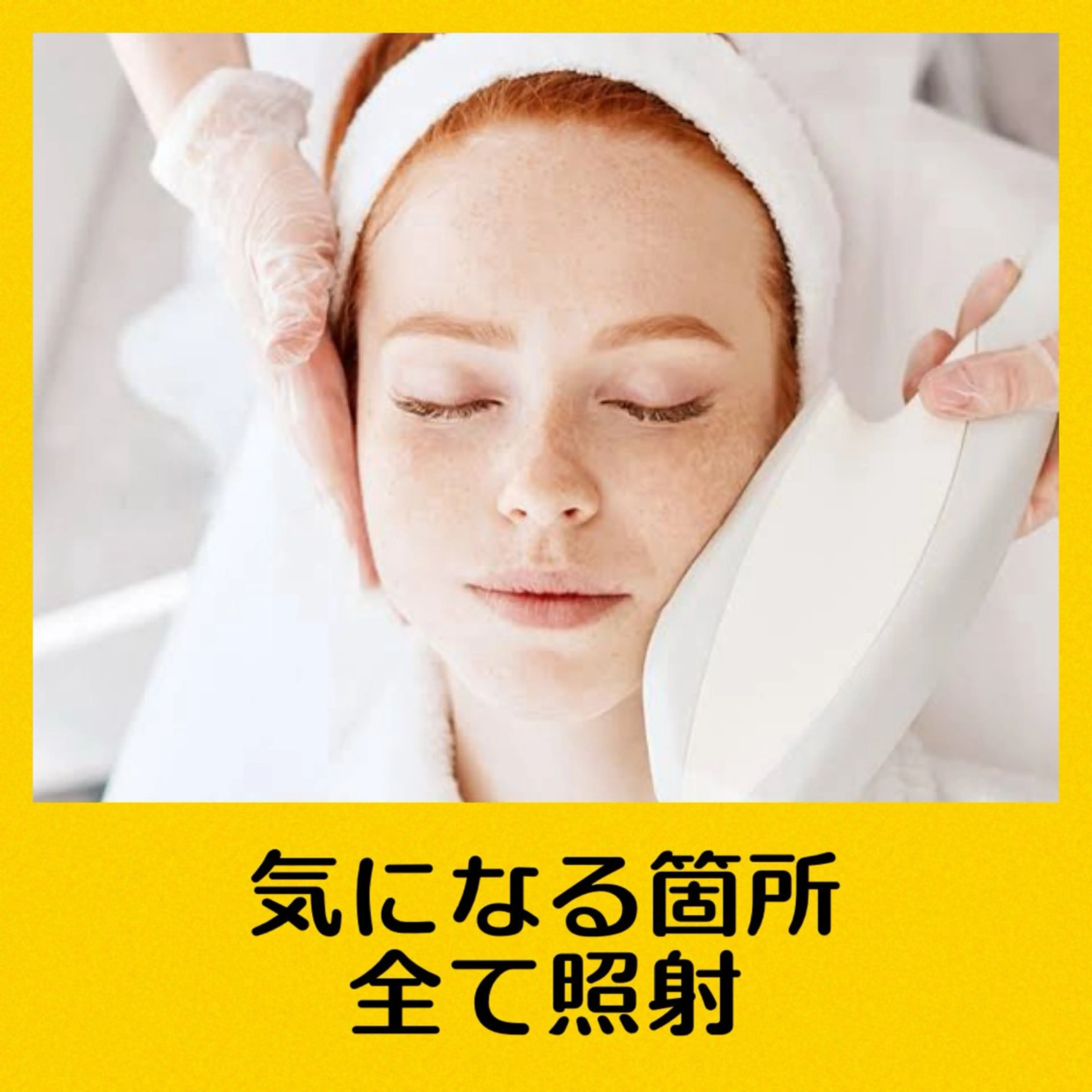 【最近脱毛器！パワー値MAX】 顔全体脱毛の写真