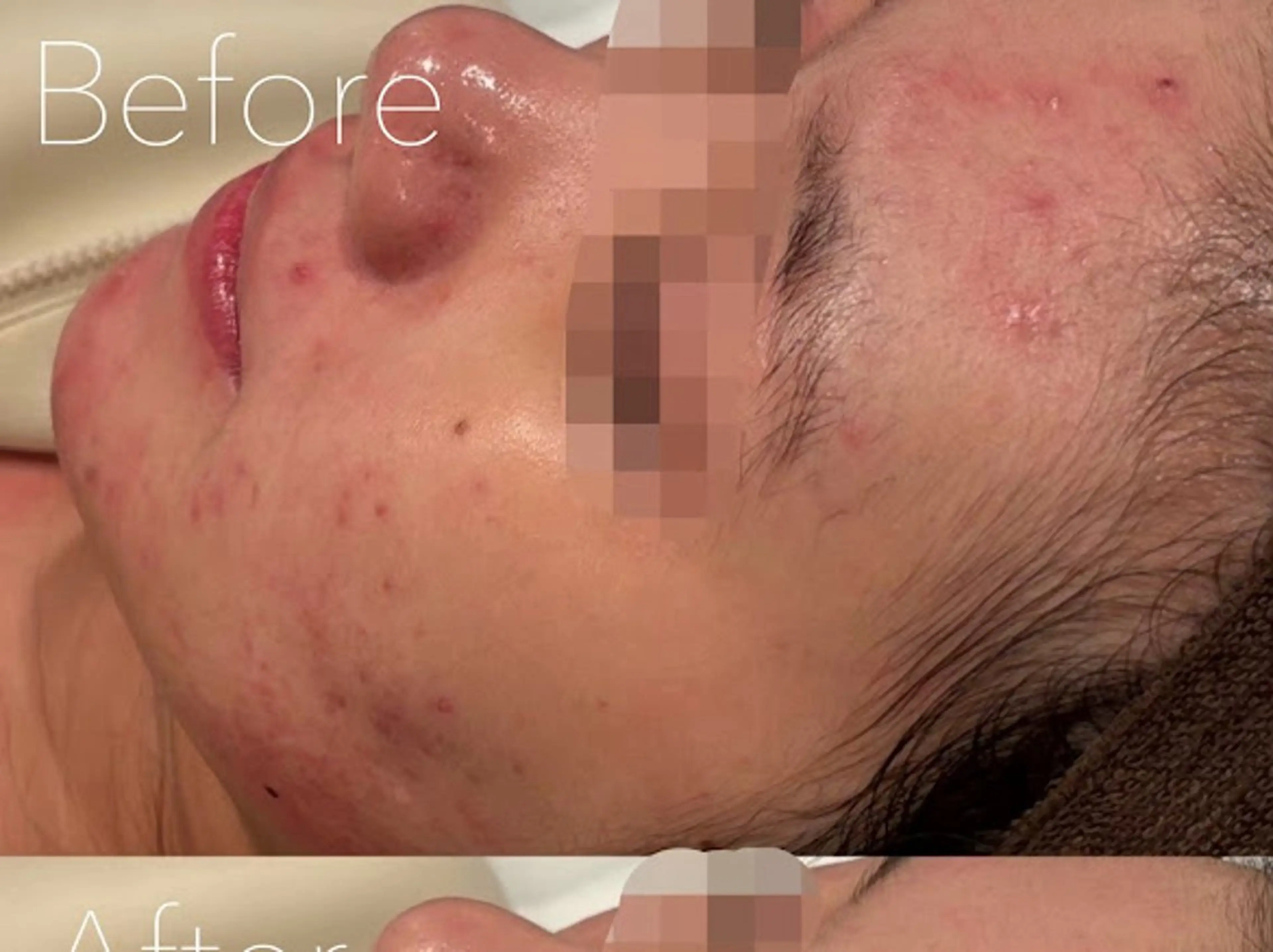 エステ 韓国肌管理Belle 神戸元町のエステ・リラクイメージ