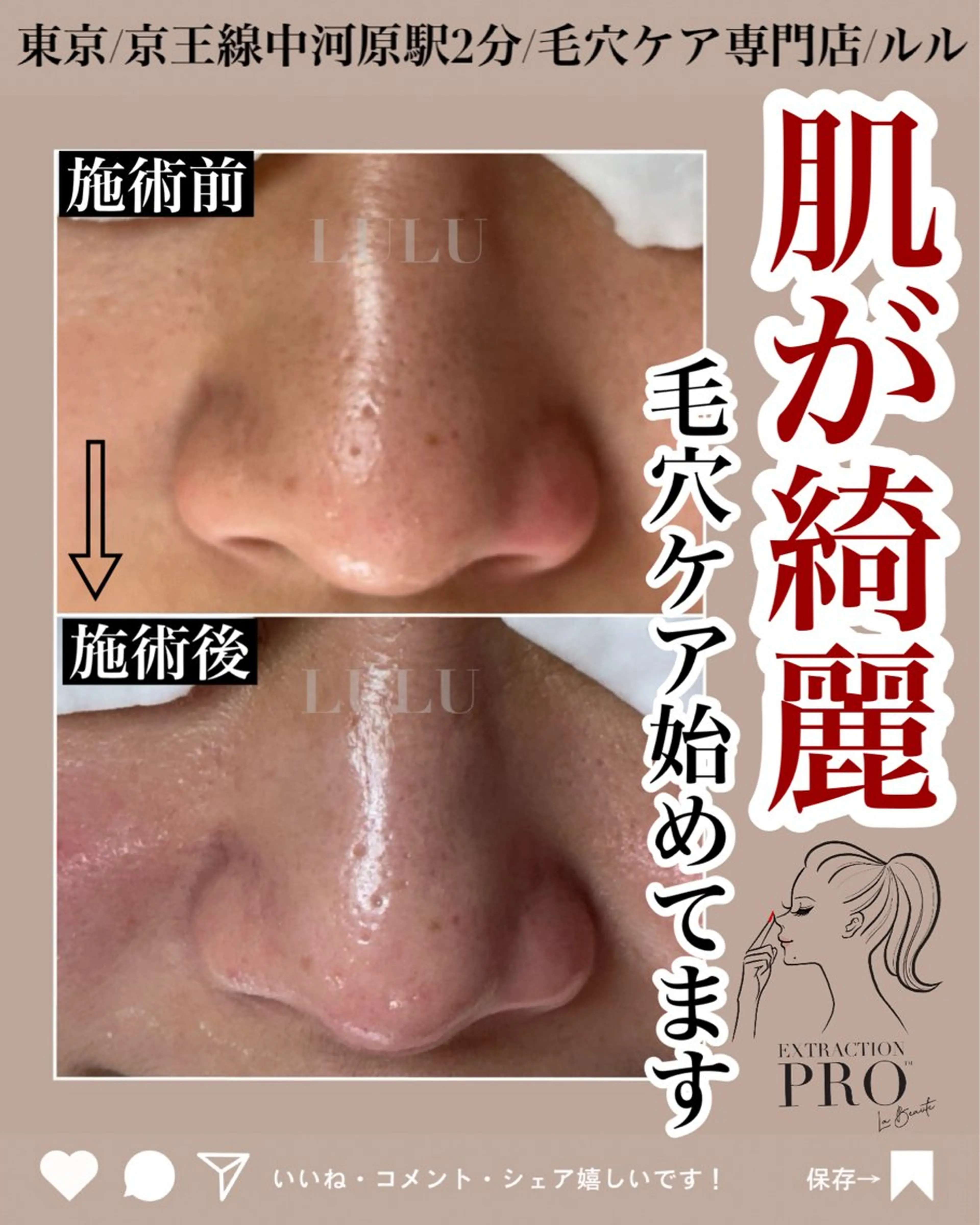 エステ LULU ルルのエステ・リラクイメージ