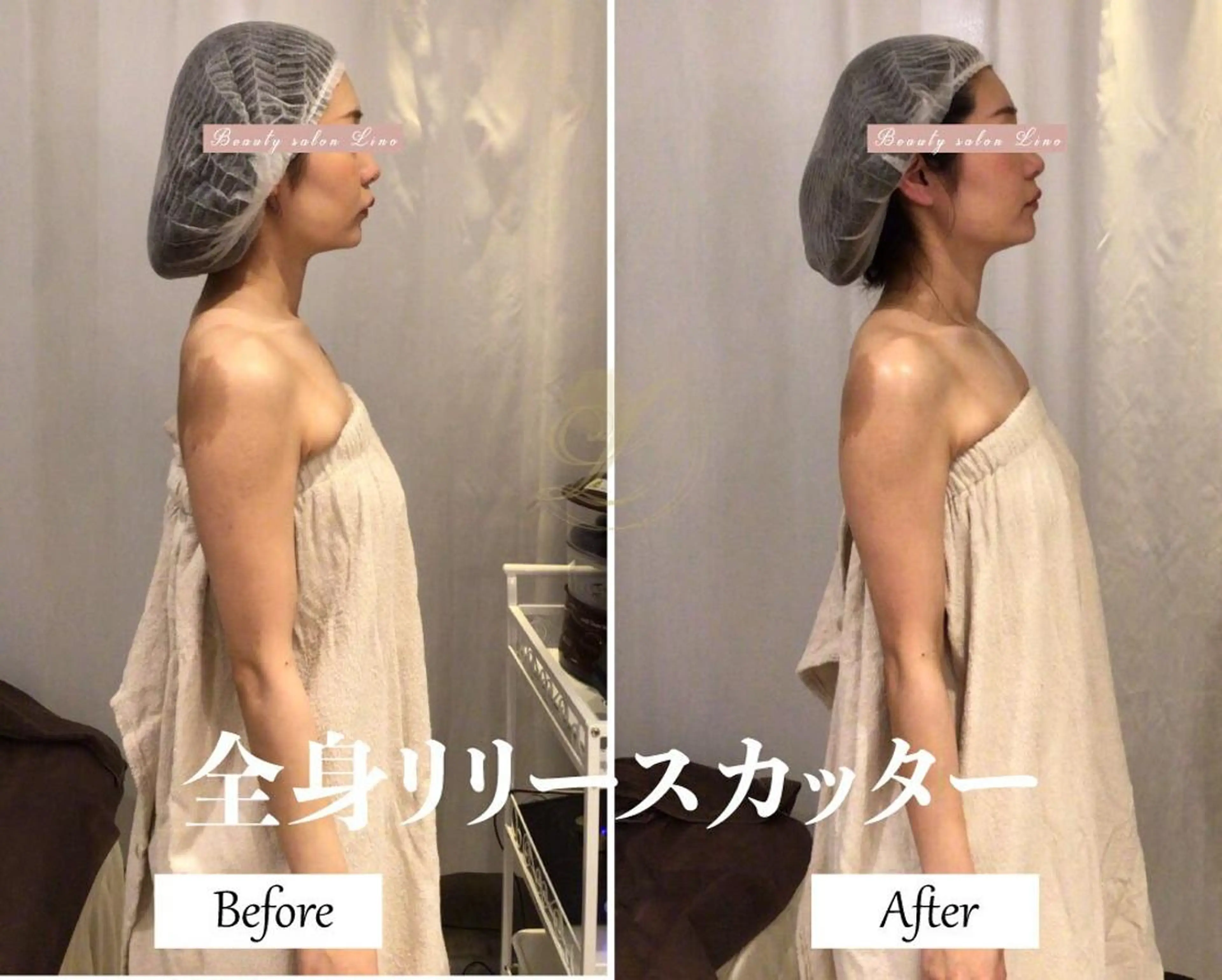 ブライダルサロン |Lino【堀江】のエステ・リラクイメージ