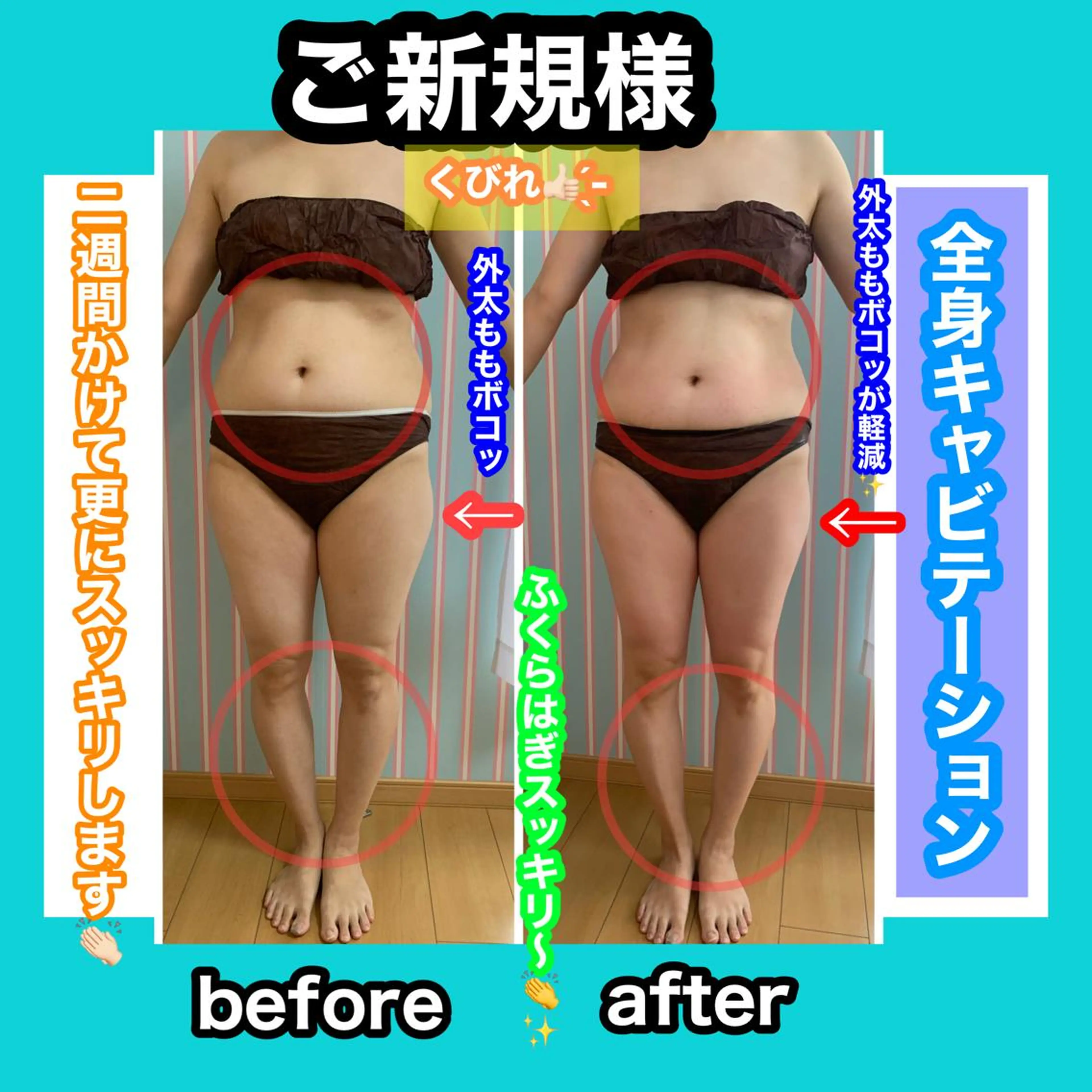 痩身/脱毛/ネイル HARUKAのエステ・リラクイメージ