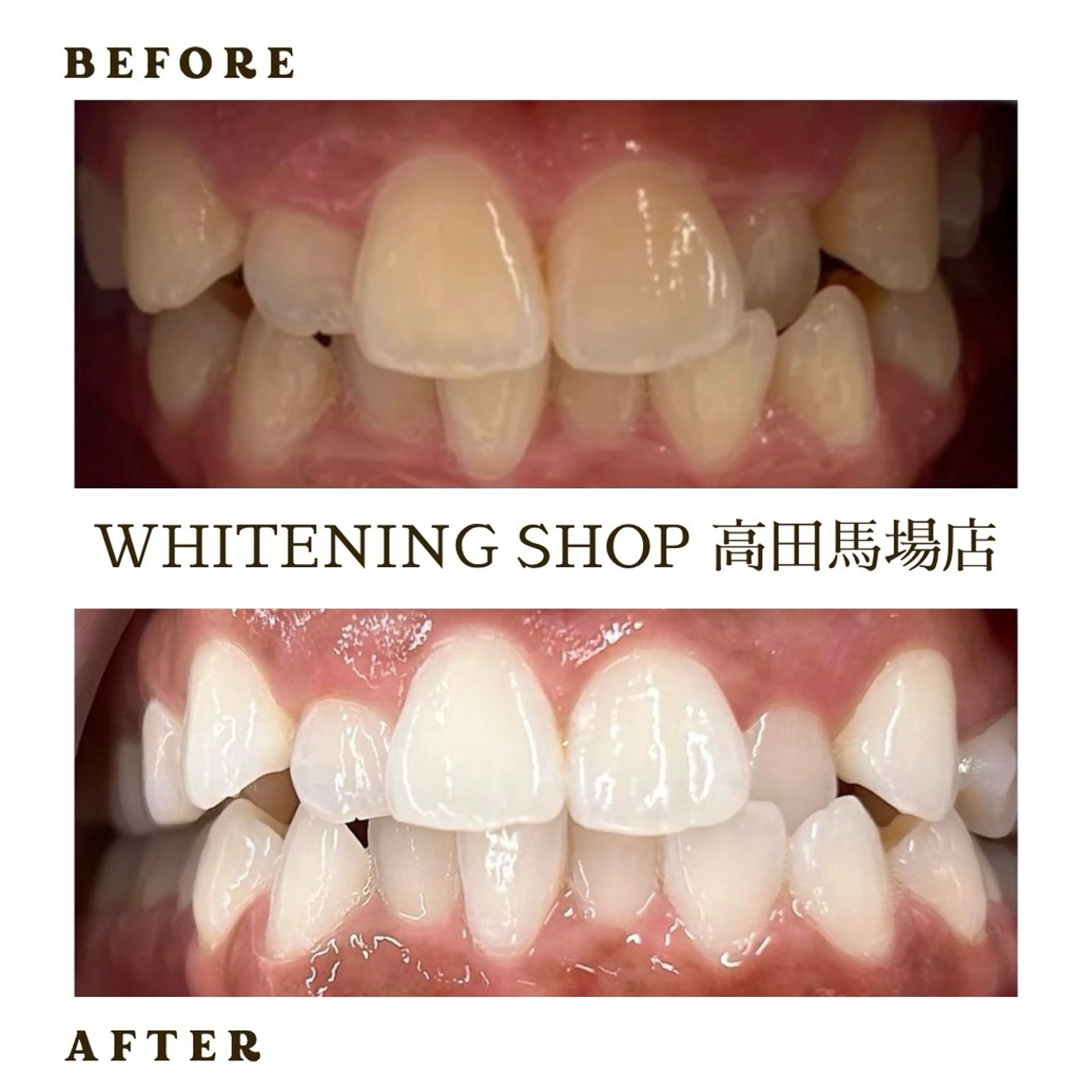 メンズ その他 ホワイトニング ショップ高田馬場店のその他イメージ