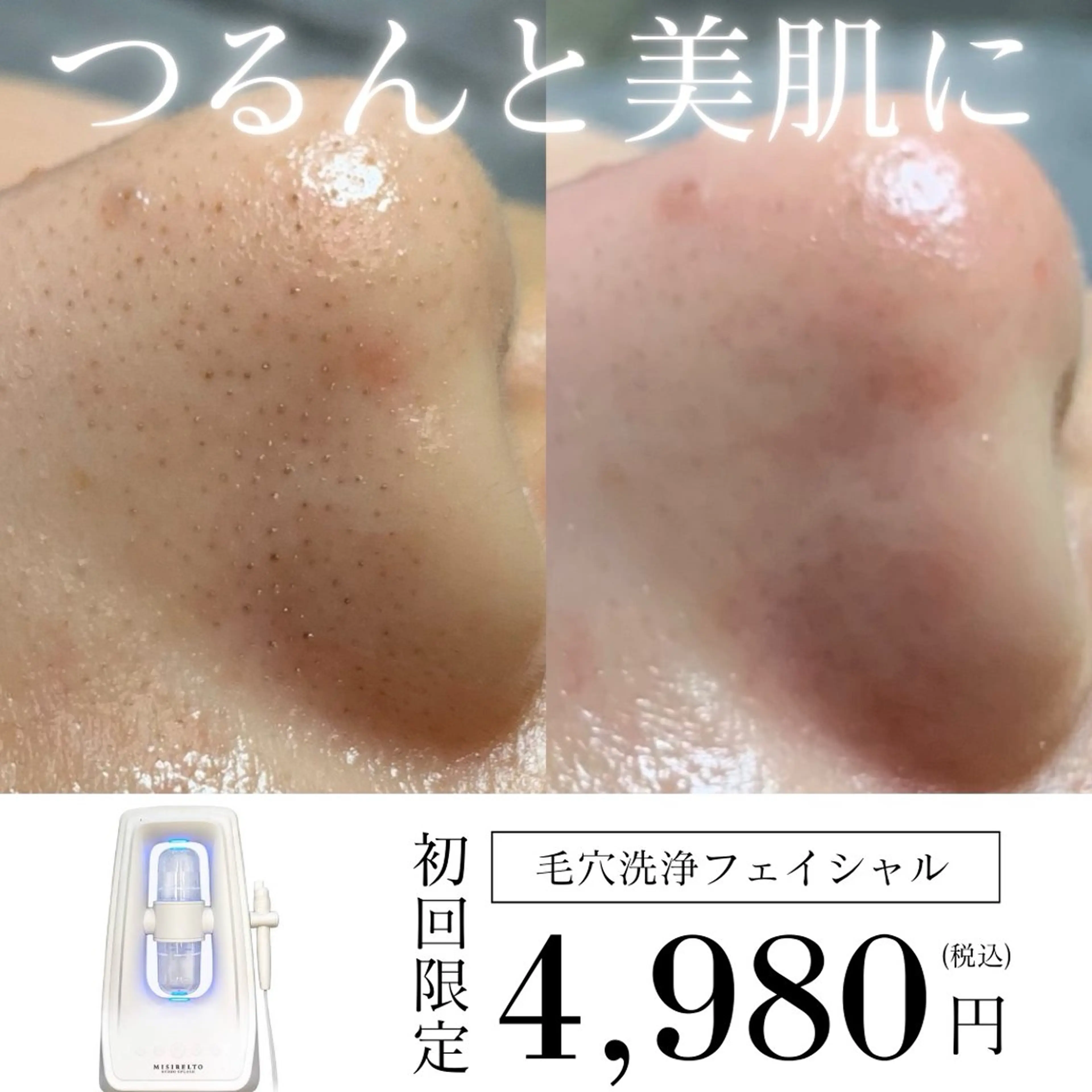 美顔・小顔専門店 LOUISの眉毛・アイブロウイメージ