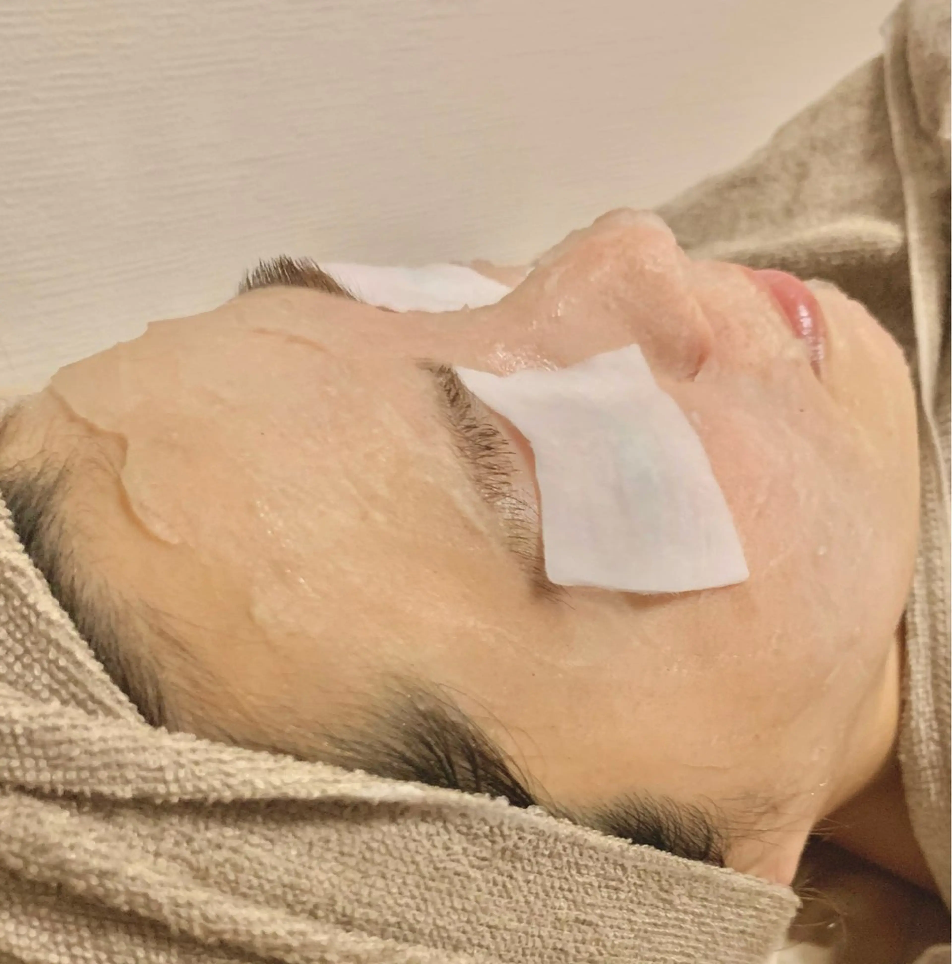 夏の日焼けしたお肌にはコレ!!!とにかく鎮静!艶玉レストセルトリートメント🩵敏感肌、炎症、美容医療後の方もコチラ❁の写真