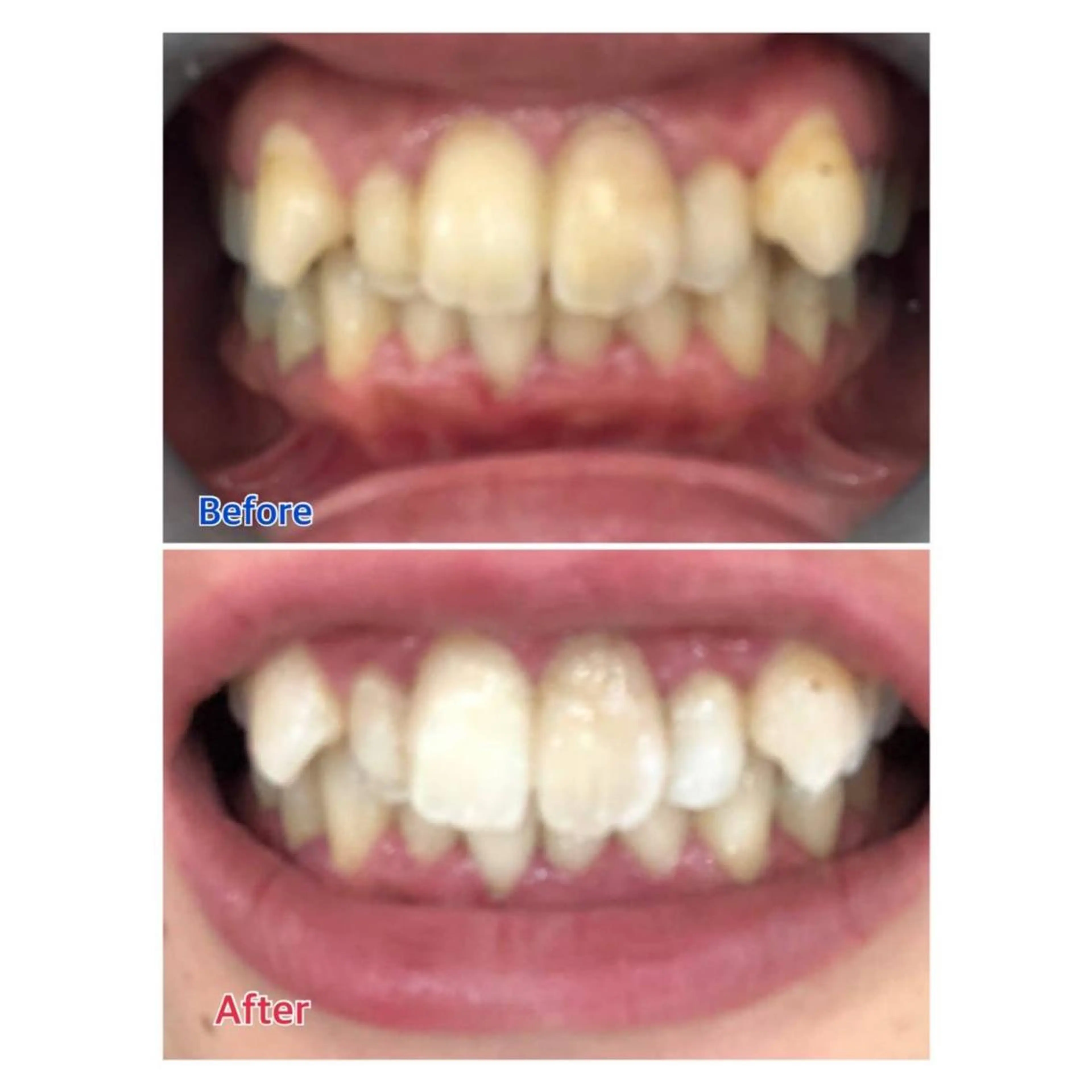 MBEAUTYSALON 千葉店・京成大久保所属・Melty 輝のその他イメージ