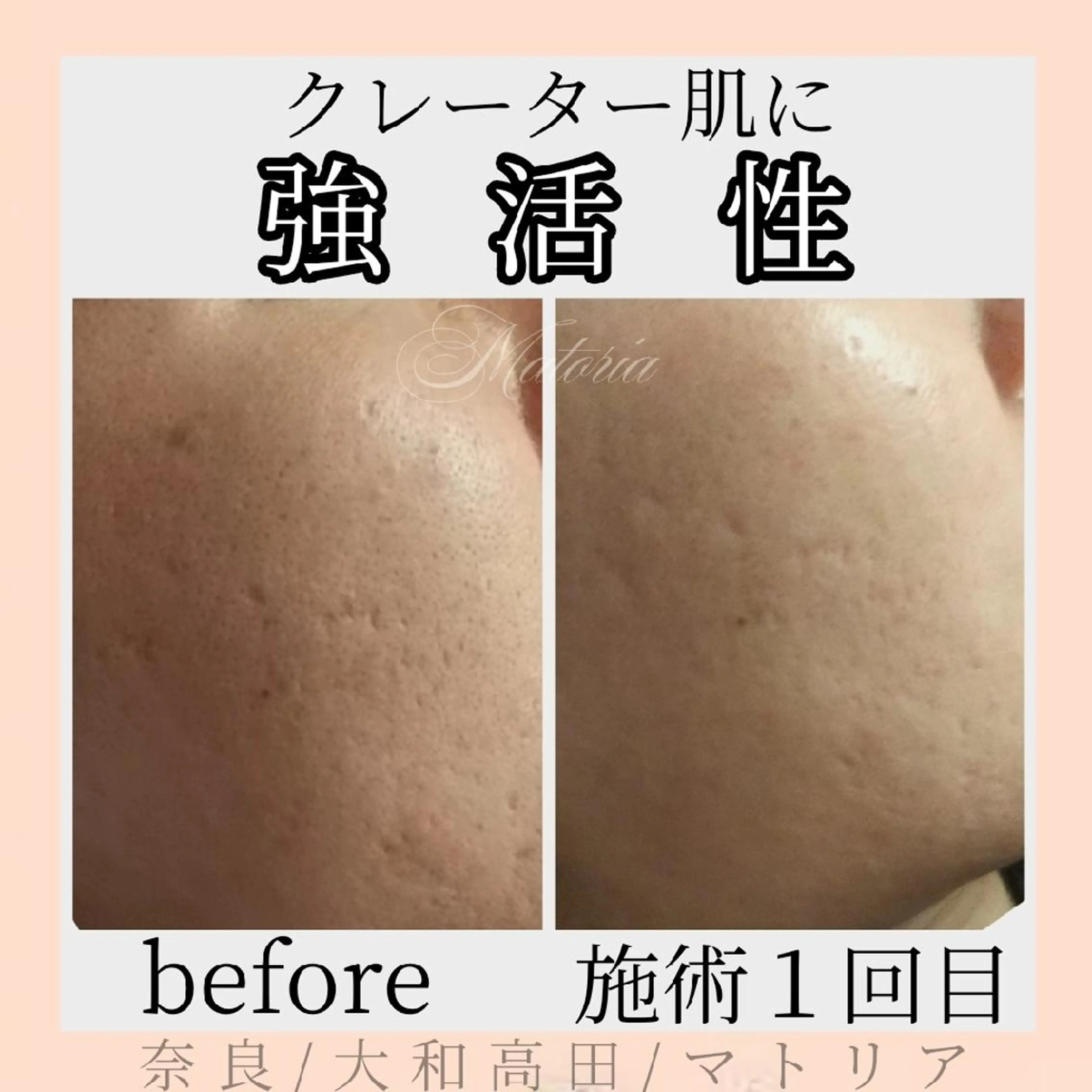 小顔と美肌 まごころエステMatoria所属・小顔 美肌専門 Matoriaのエステ・リラクイメージ