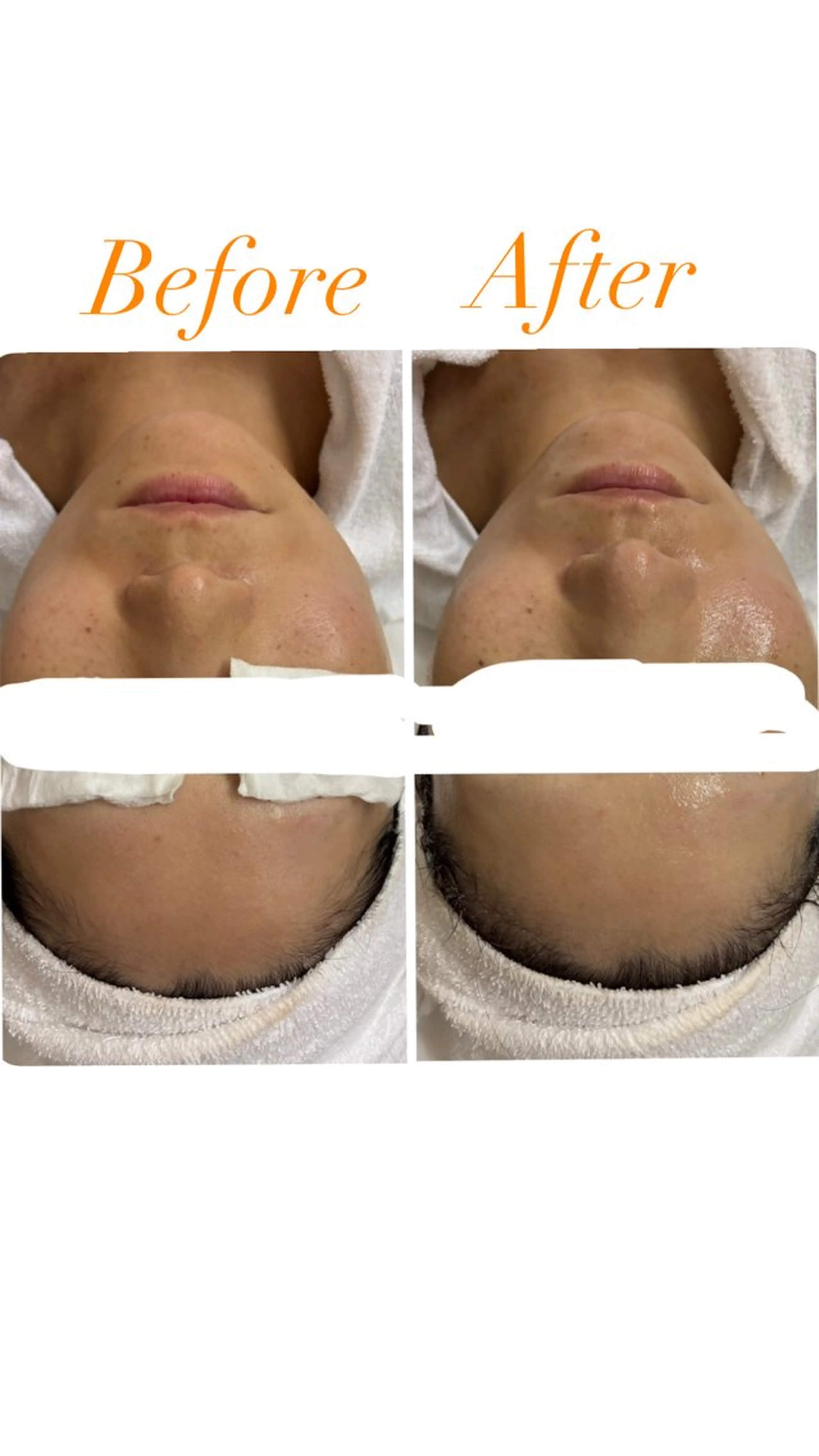 エステ 久留本 茜のエステ・リラクイメージ