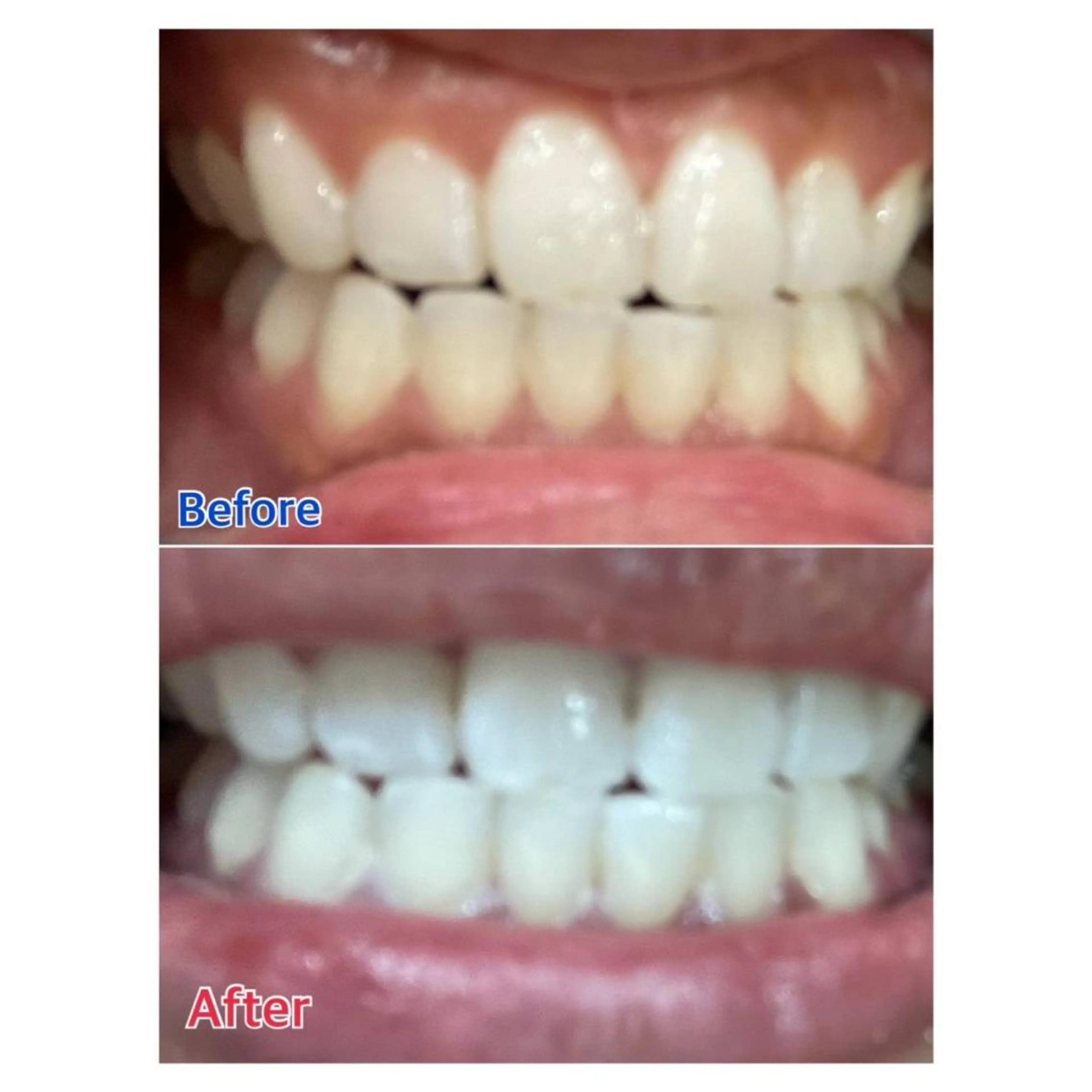 Melty 輝のその他イメージ