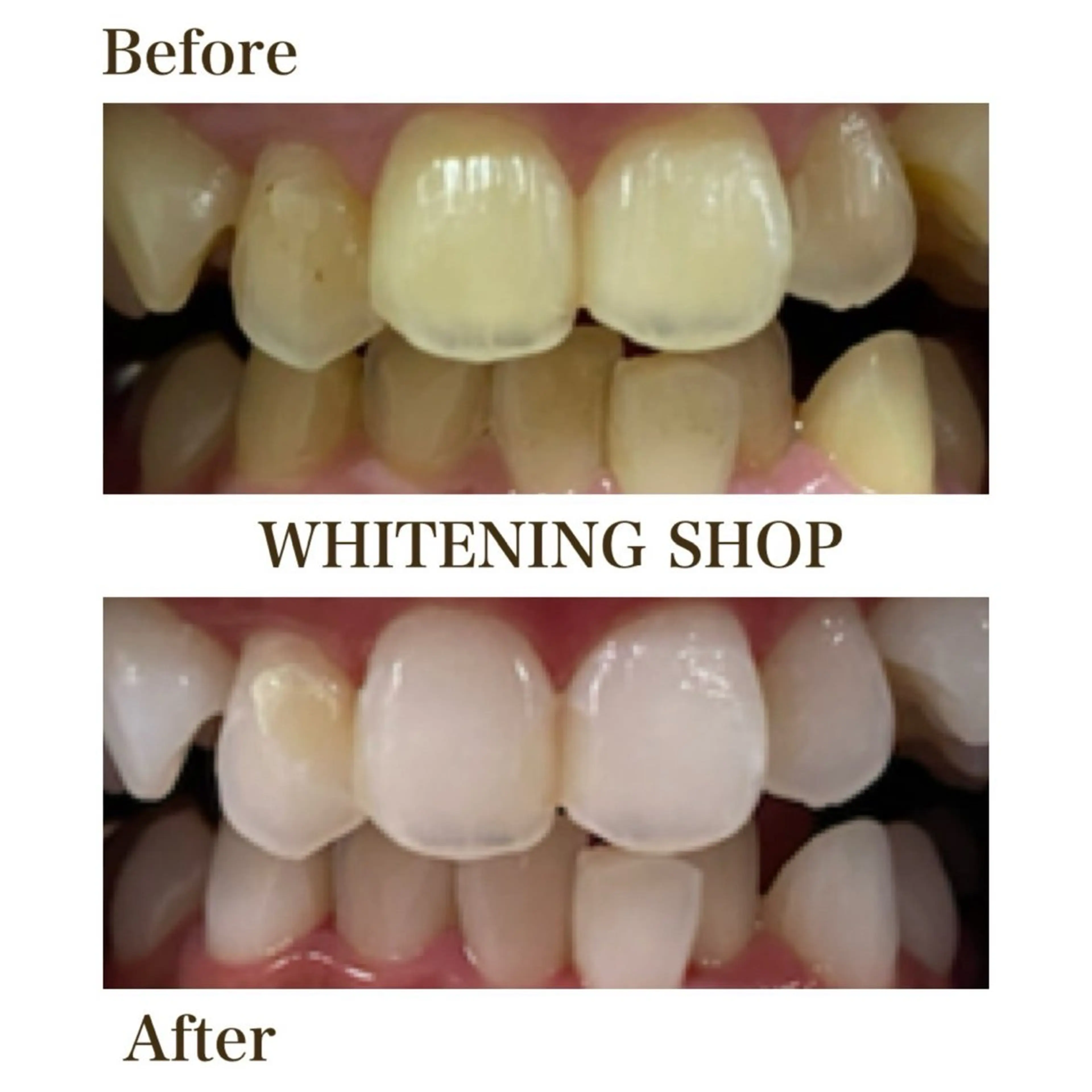 ホワイトニングショップ静岡葵区店所属・ホワイトニング ショップ葵区静岡駅店のその他イメージ