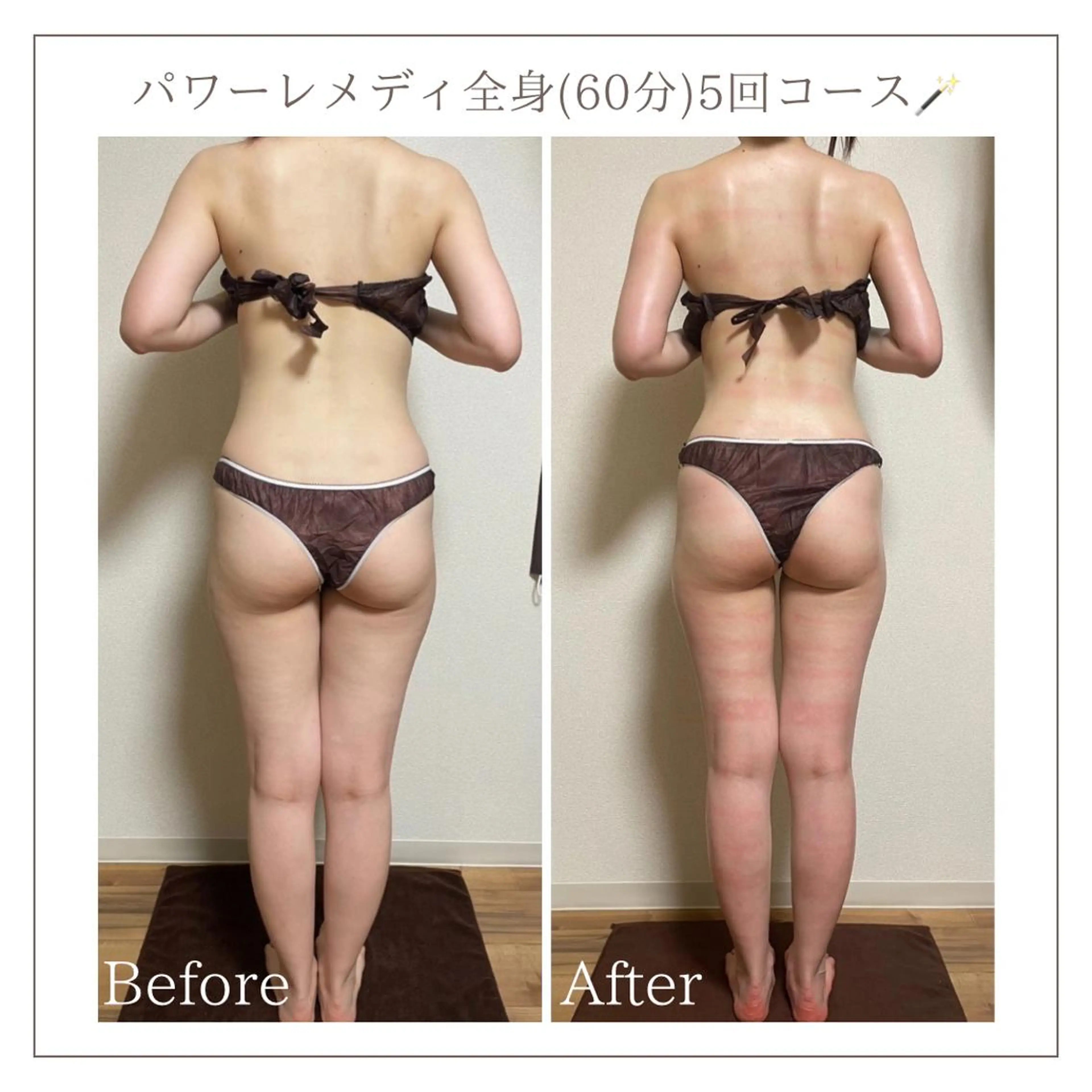 エステ リラク Luca 痩身• 疲労改善×韓国肌管理のエステ・リラクイメージ