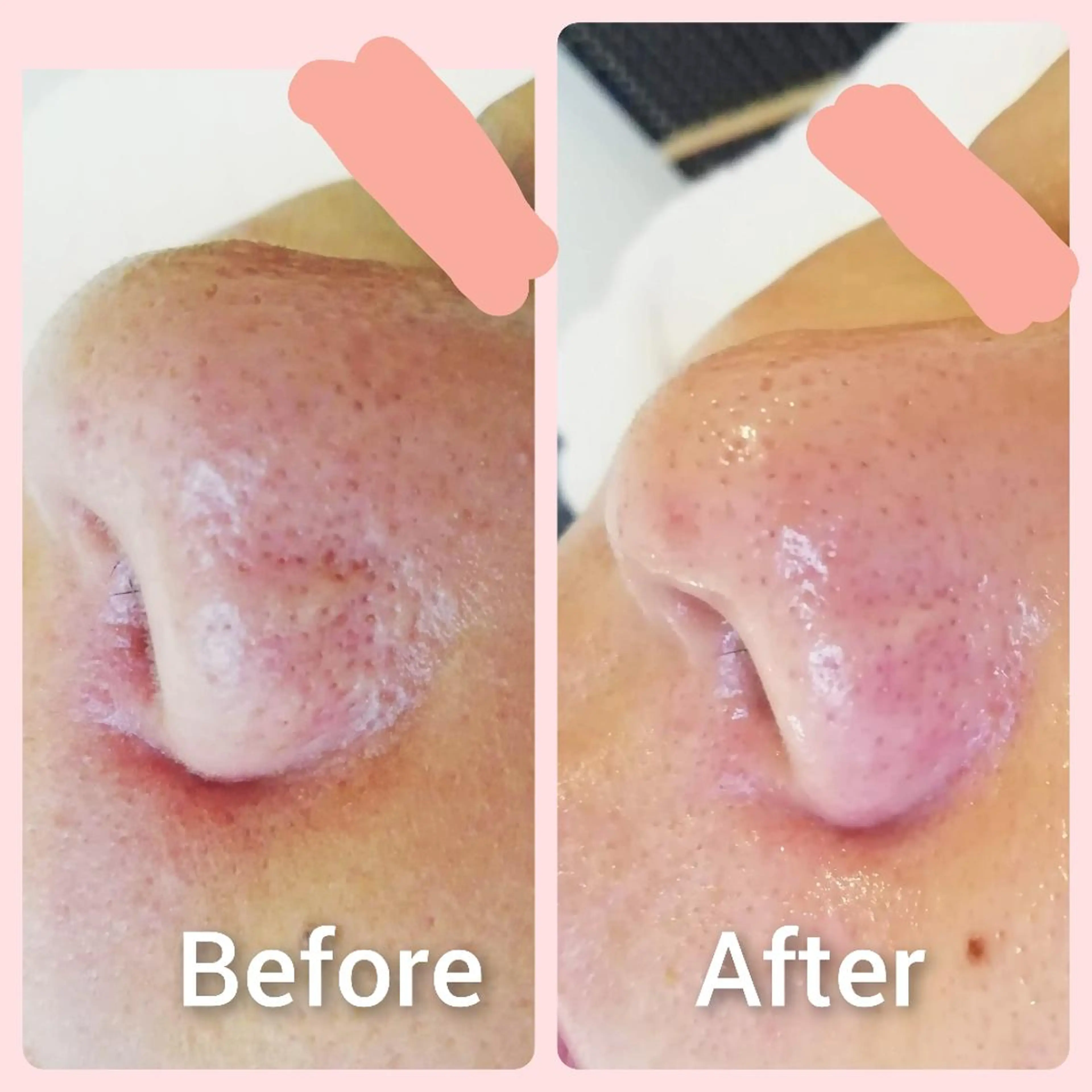 エステ 川口 春奈のエステ・リラクイメージ