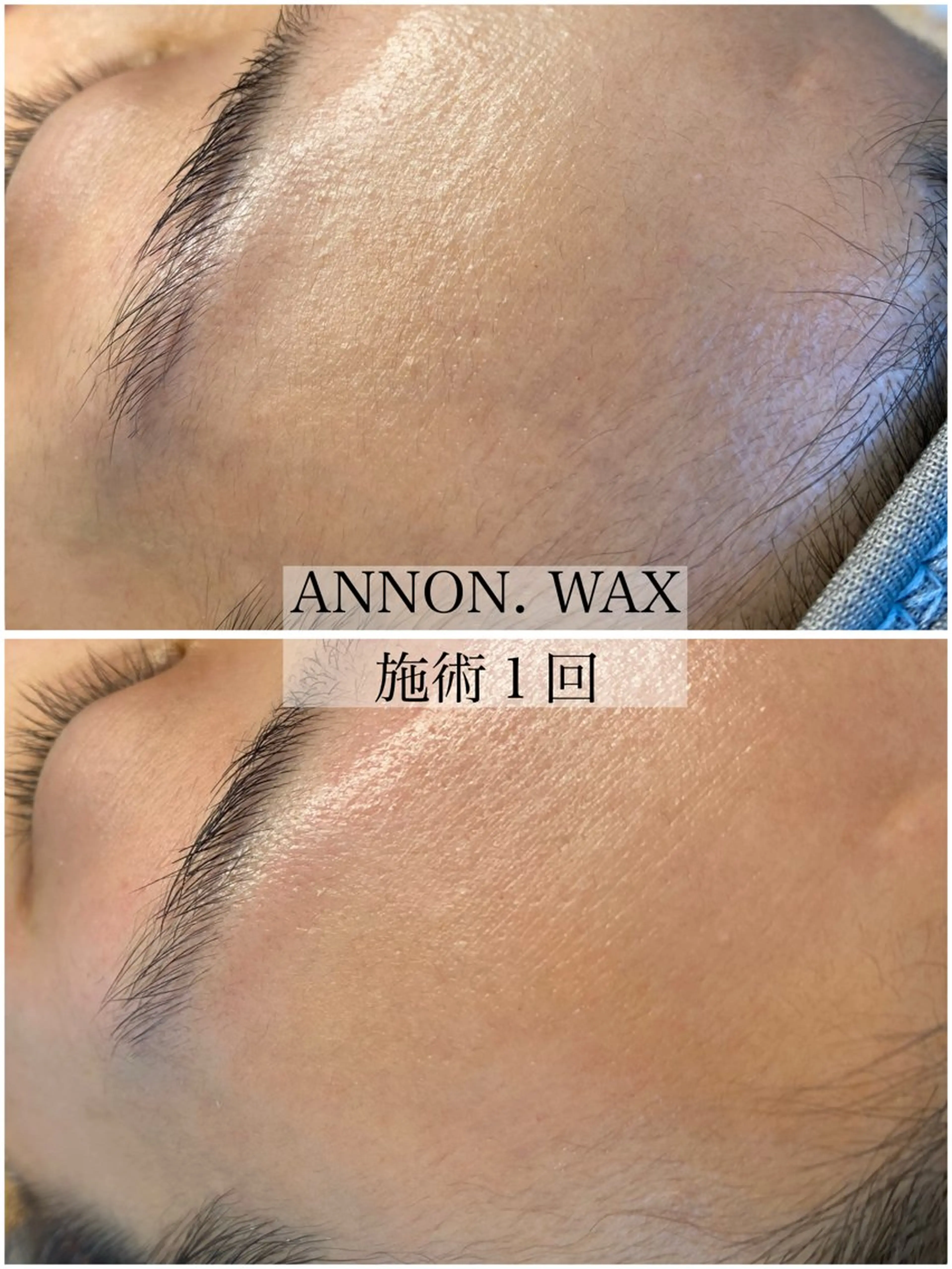 エステ 肌質改善ワックス専門 yukiのエステ・リラクイメージ