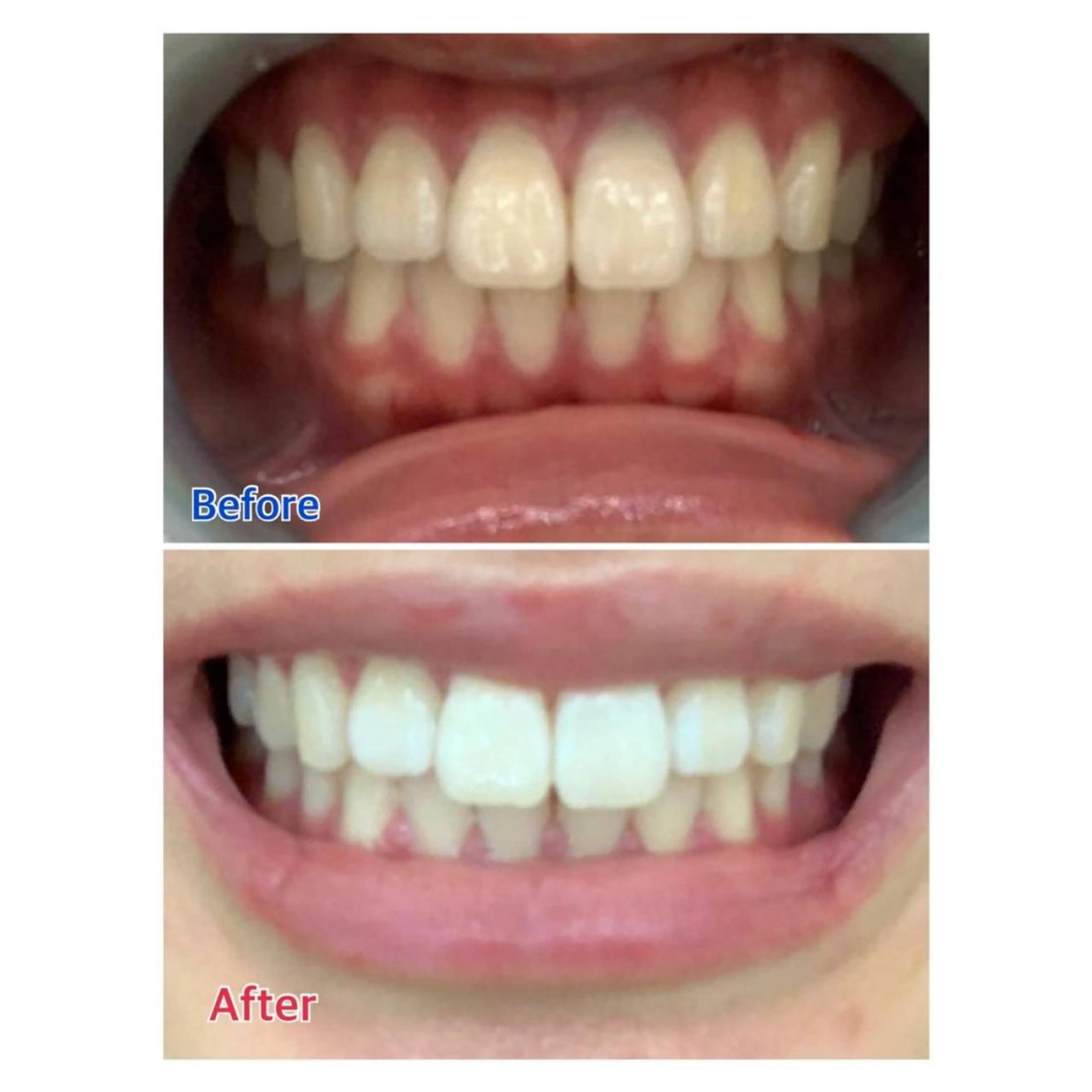 Melty 輝のその他イメージ