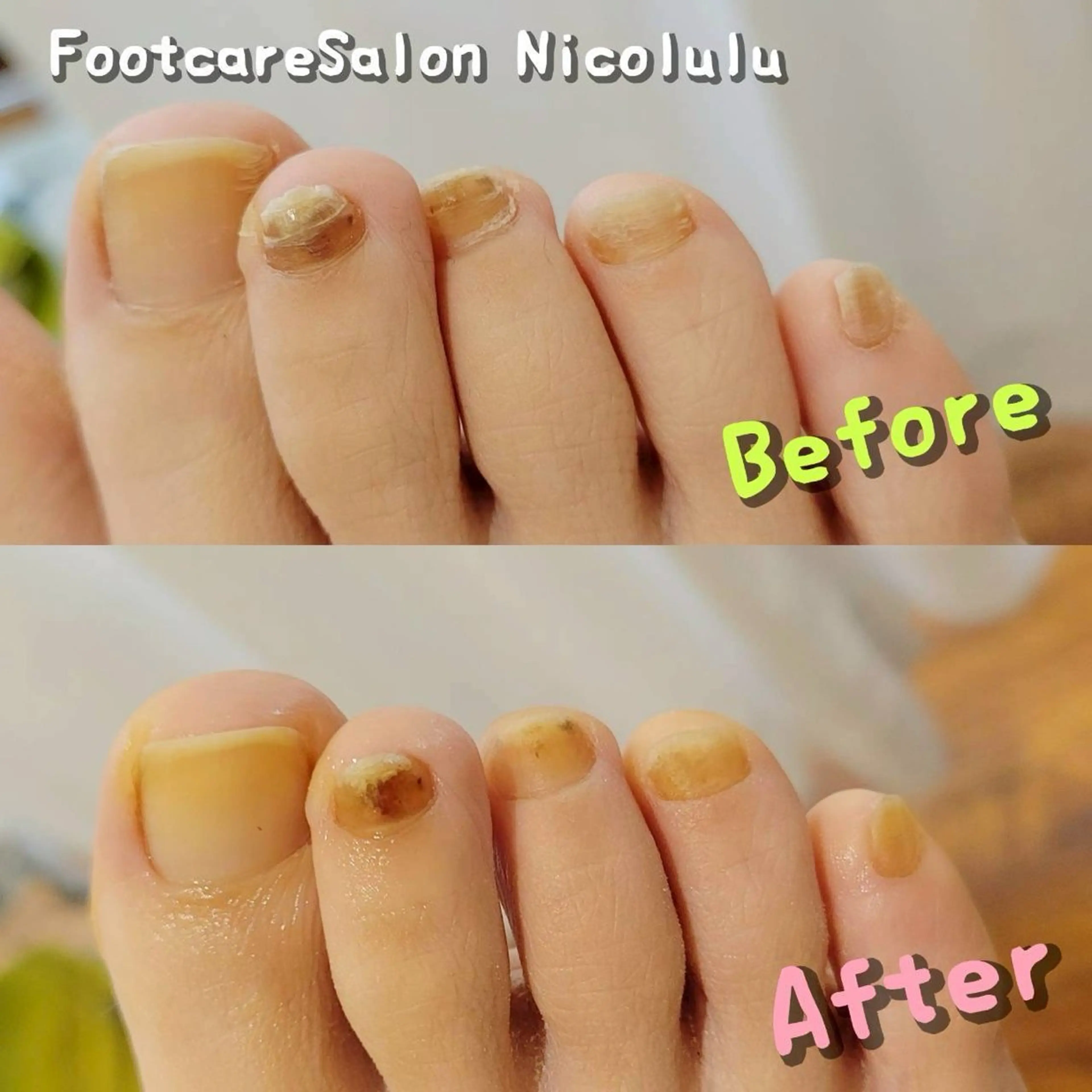 メンズ 足トラブル専門 ニコルル金沢のエステ・リラクイメージ