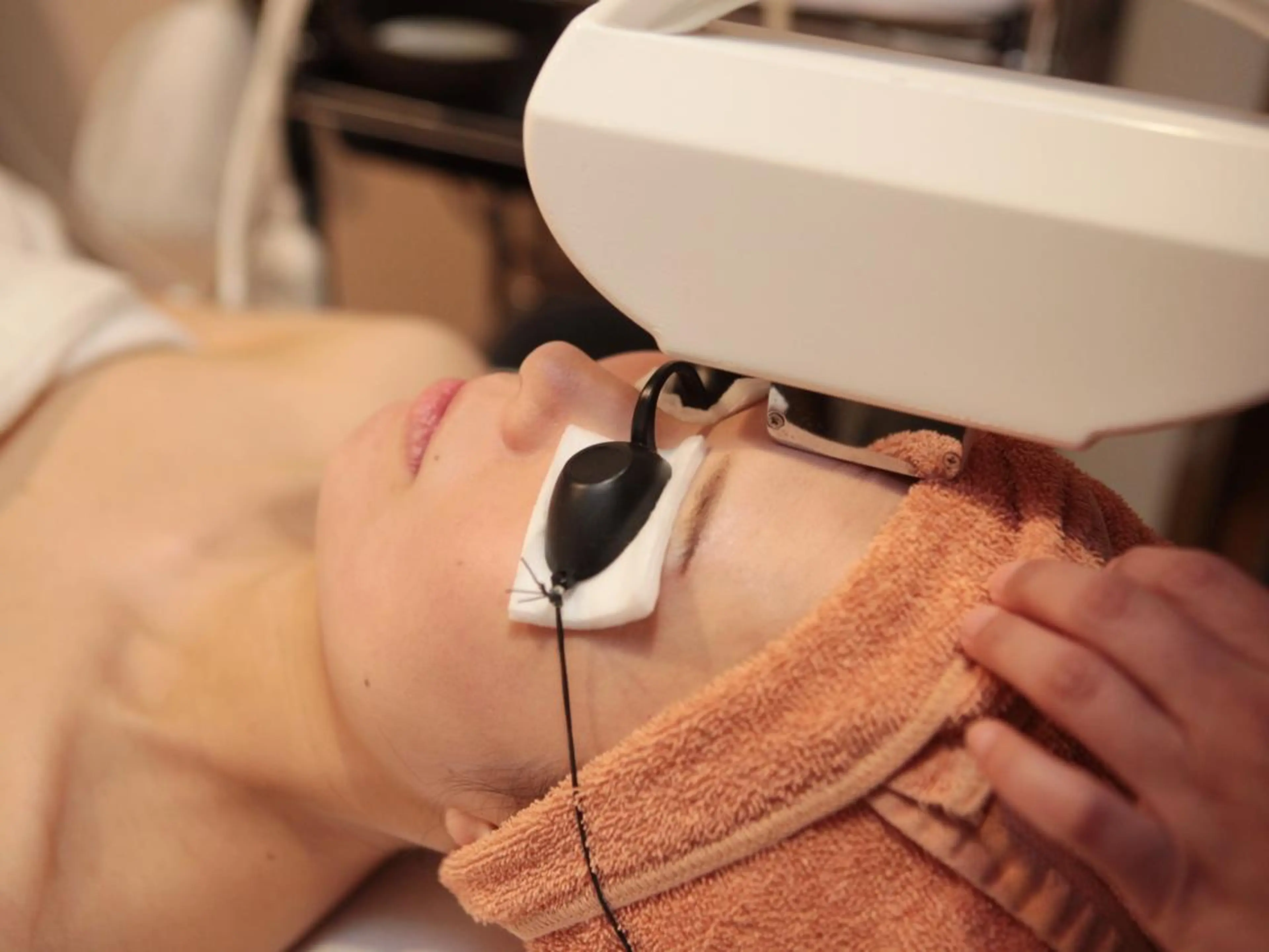 【新規】【毛穴がキュッと引き締まる】顔脱毛1回の写真