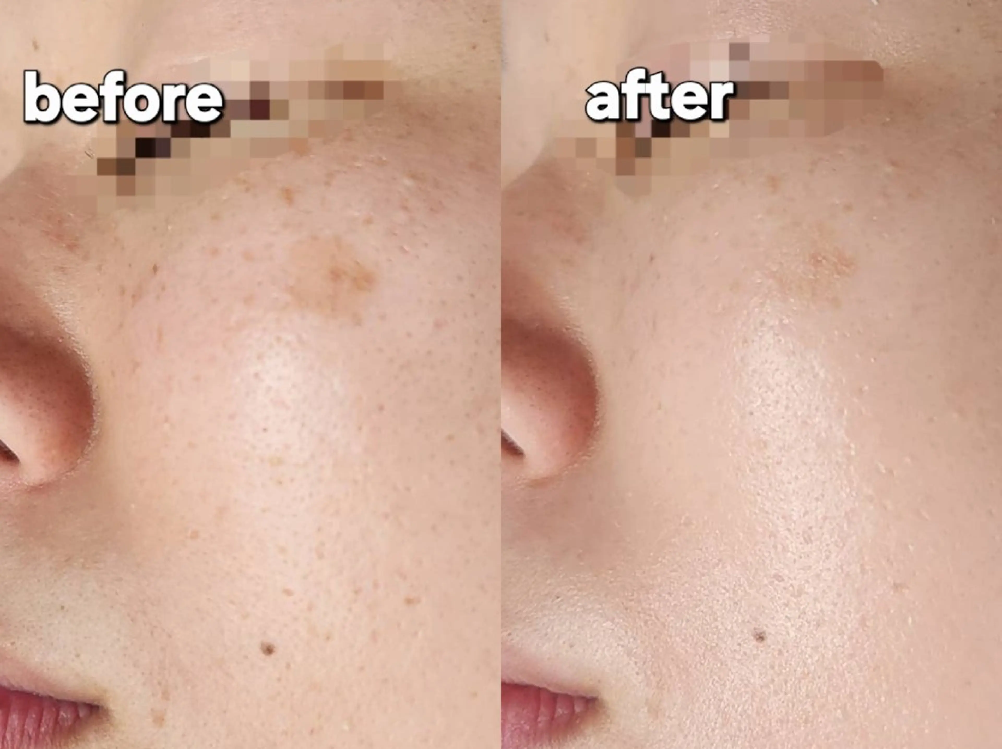 エステ Shiny ✧︎*。のエステ・リラクイメージ