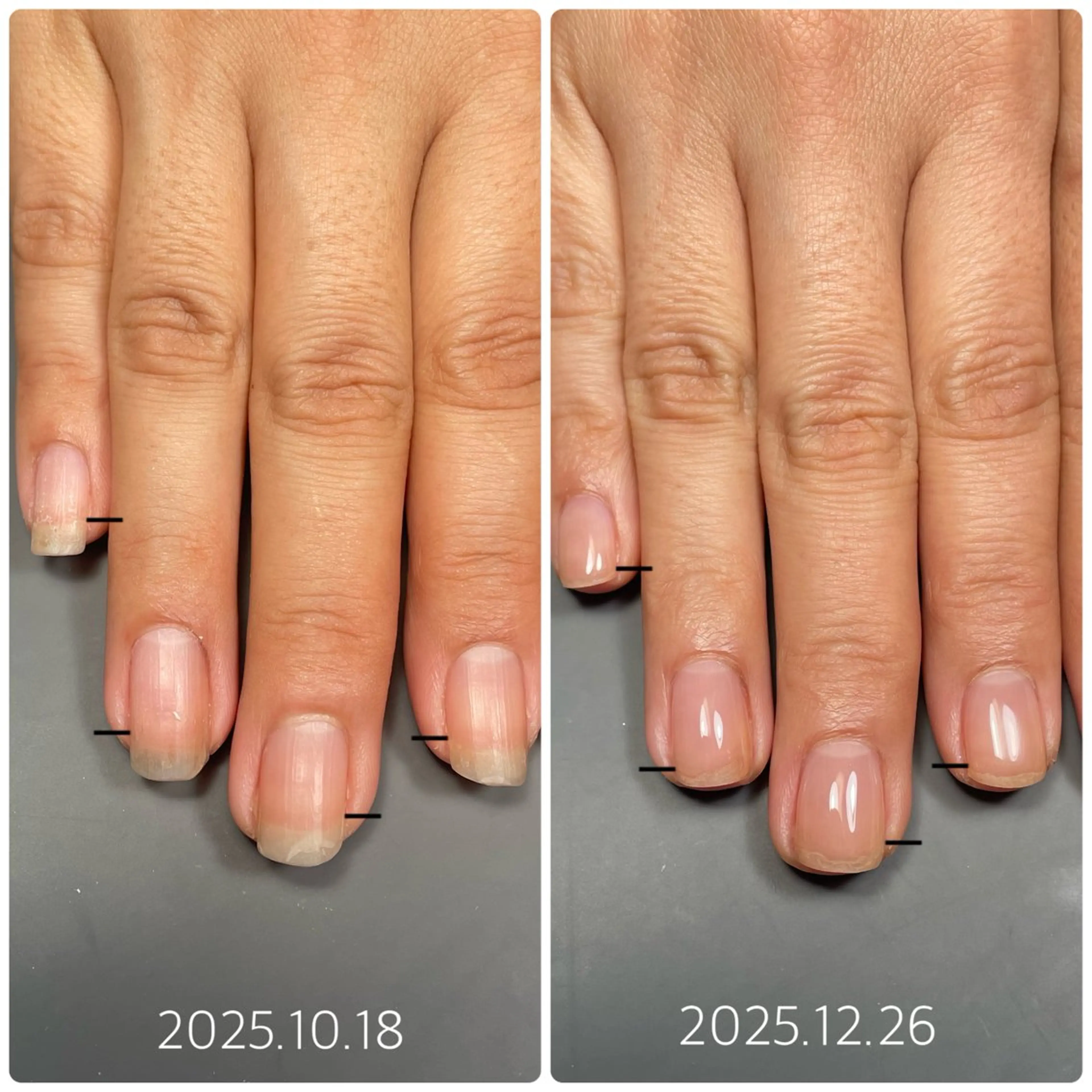 ネイル ハンドネイル 後藤 ももえのネイルデザイン