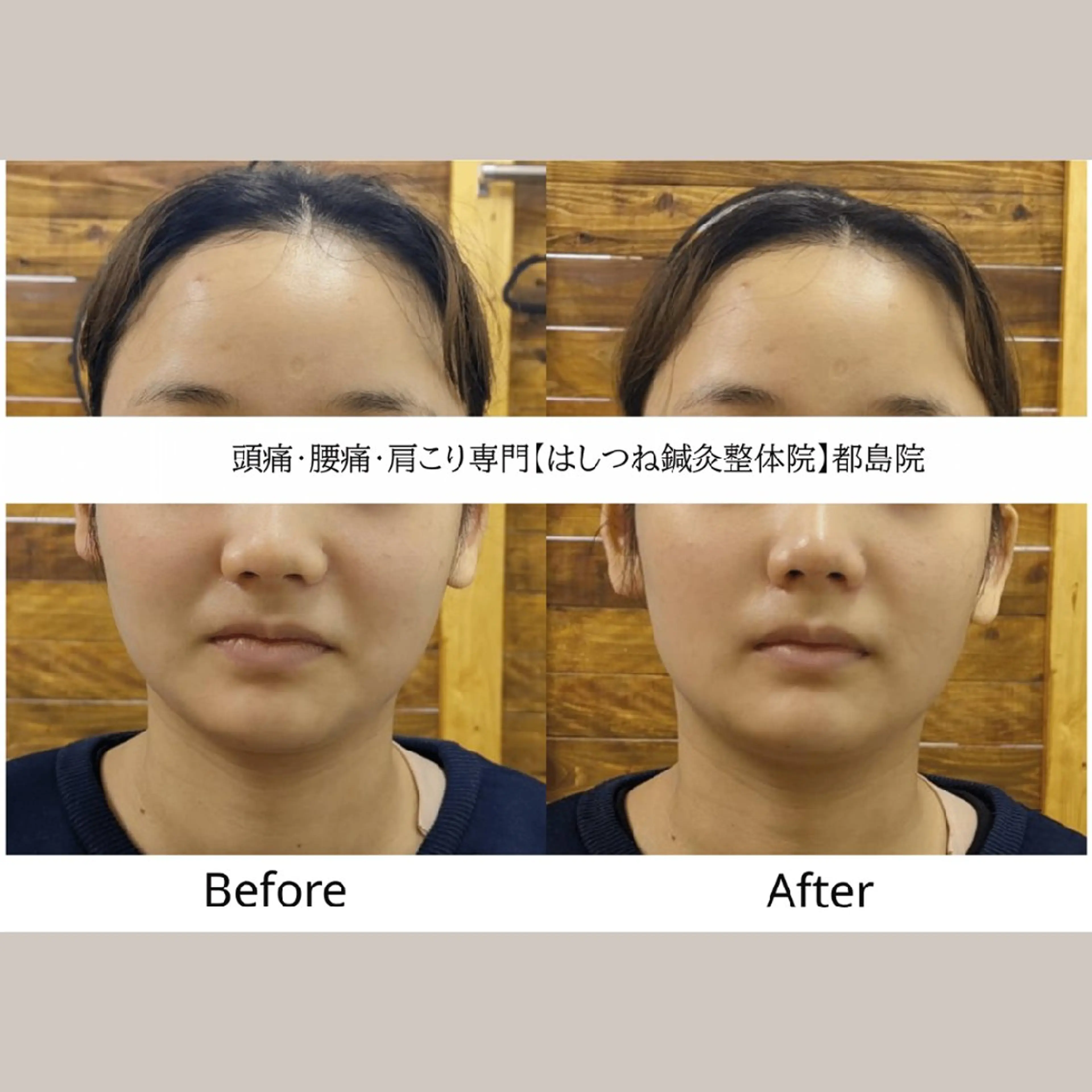 頭痛・腰痛・肩こり 特化してます。　橋岡のエステ・リラクイメージ