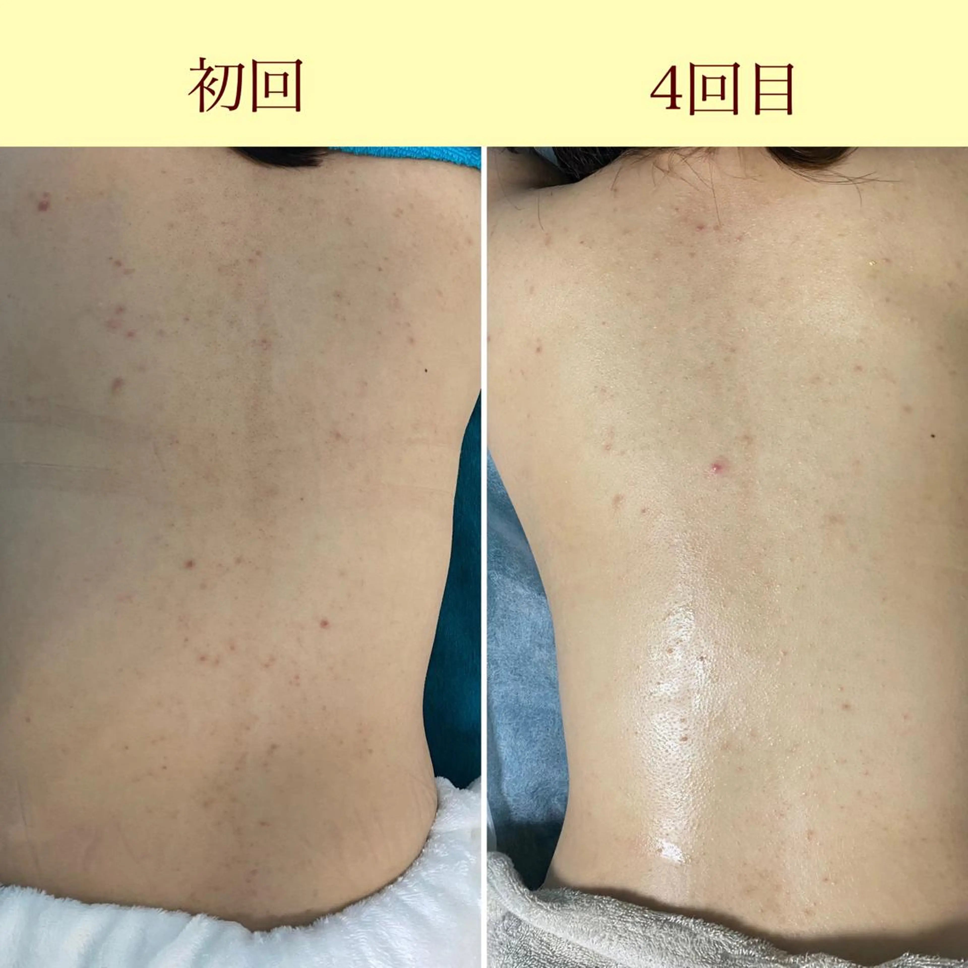 メンズ歓迎🙆‍♀️ エステ/ネイルISTのネイルデザイン